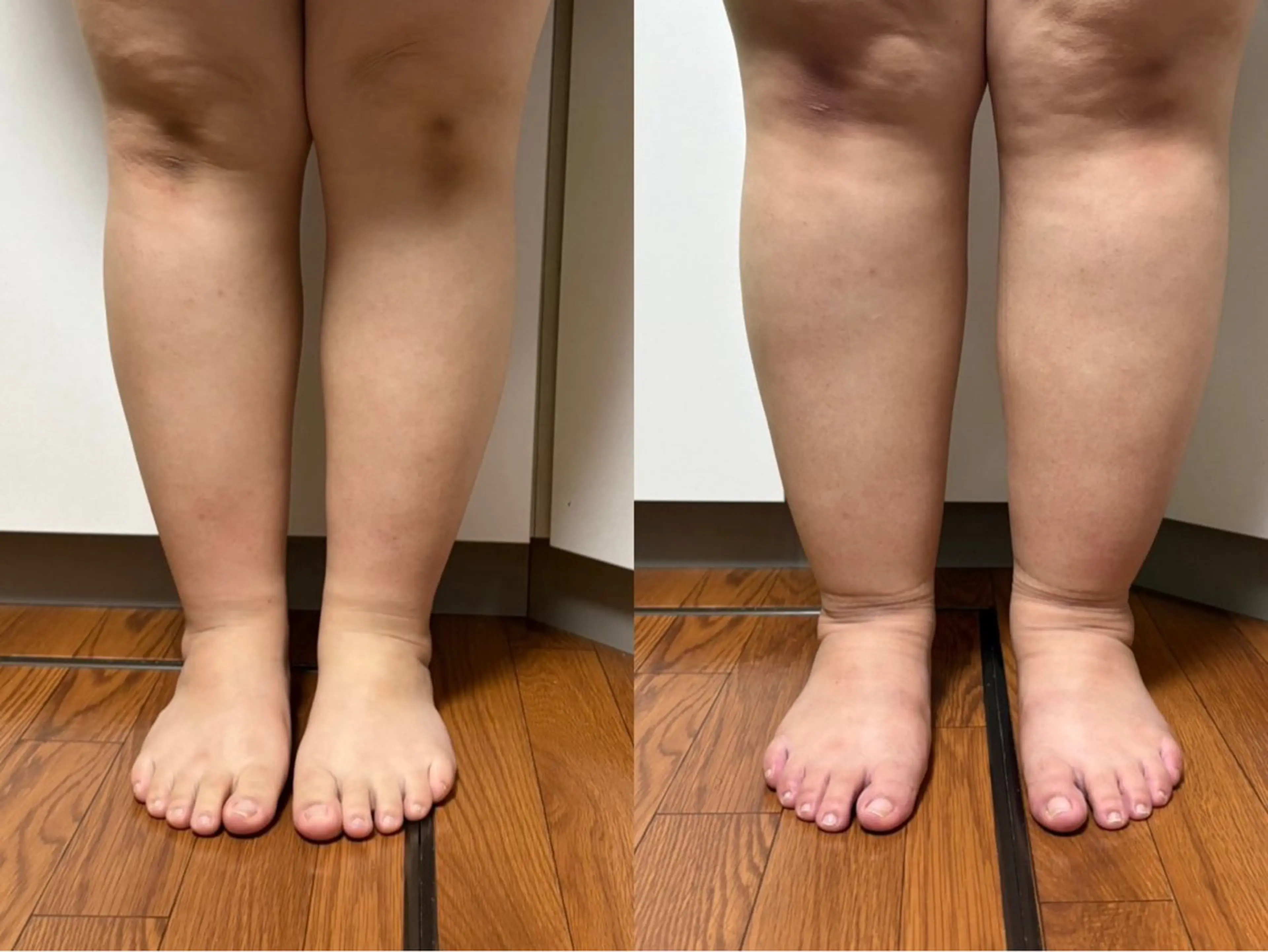 美脚コースの写真