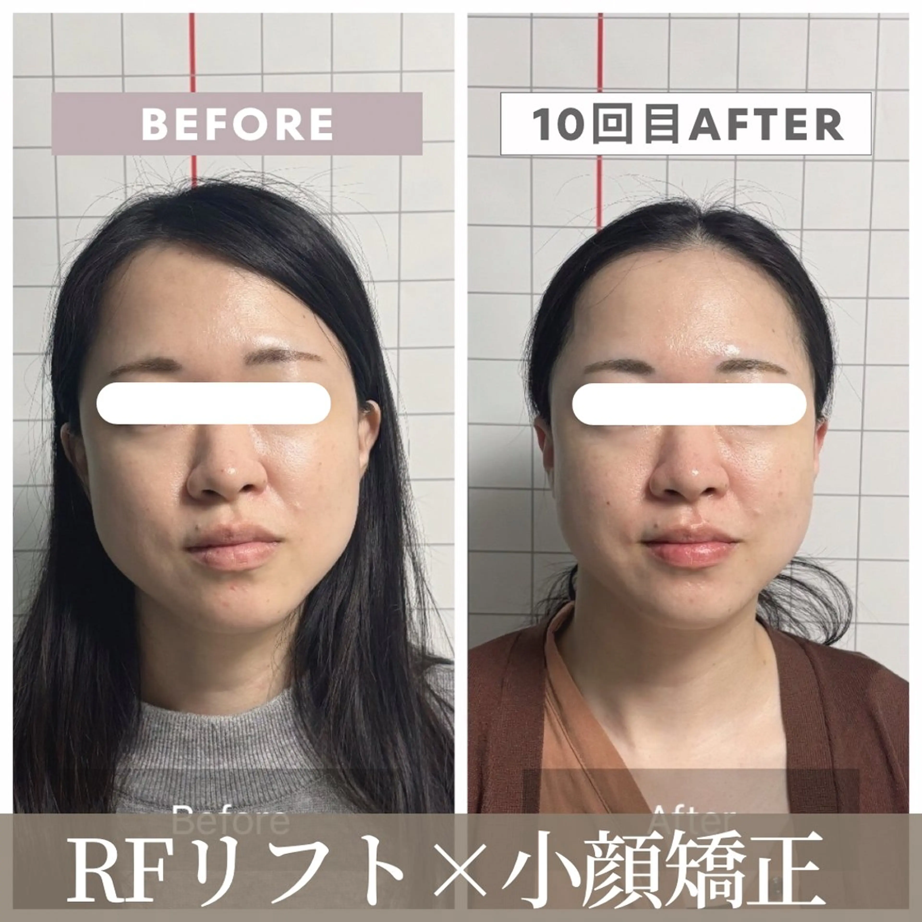 エステ リラク 小顔矯正専門店 【RED】池田のエステ・リラクイメージ