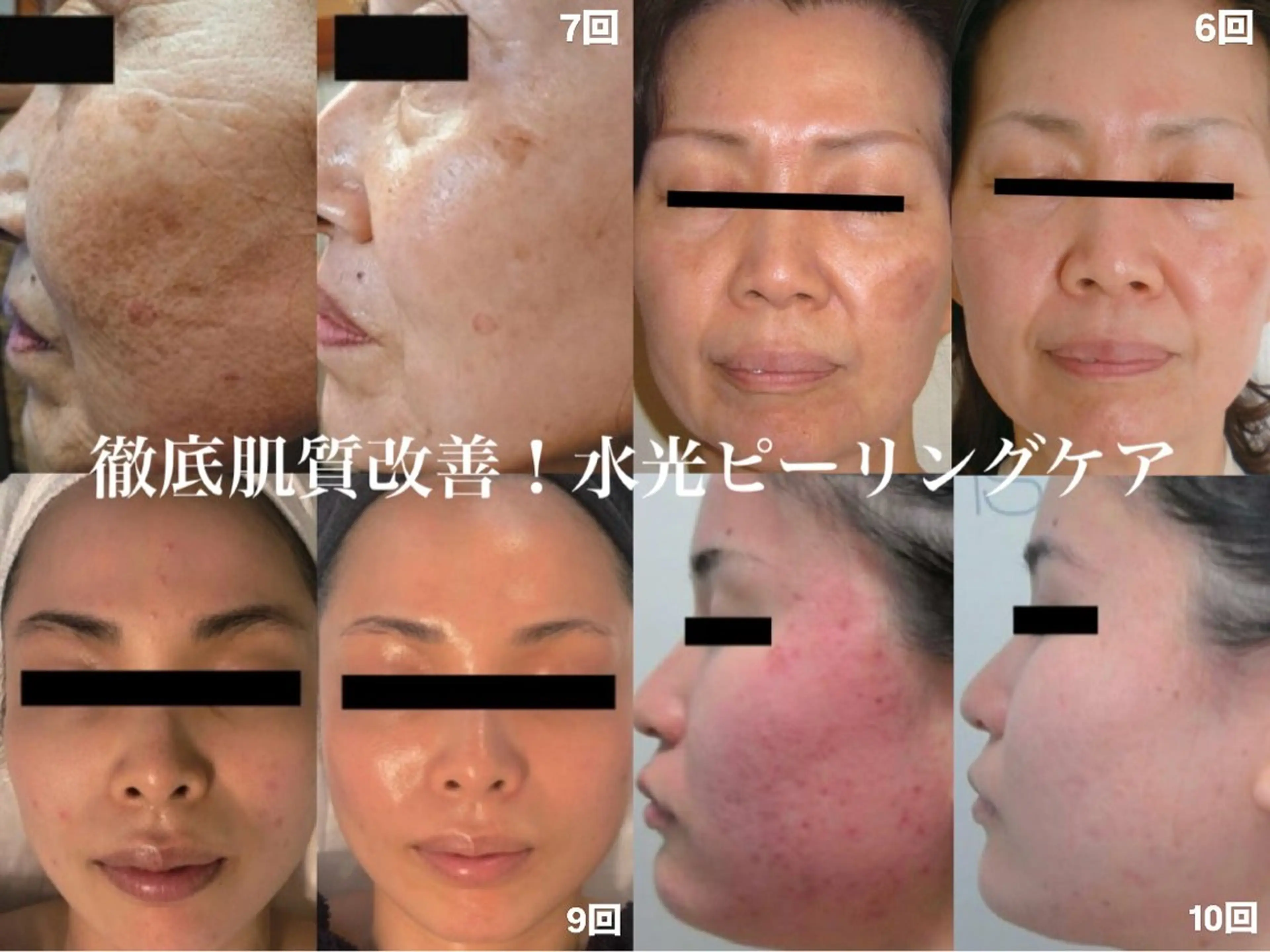 MYubelle ミューベルのエステ・リラクイメージ