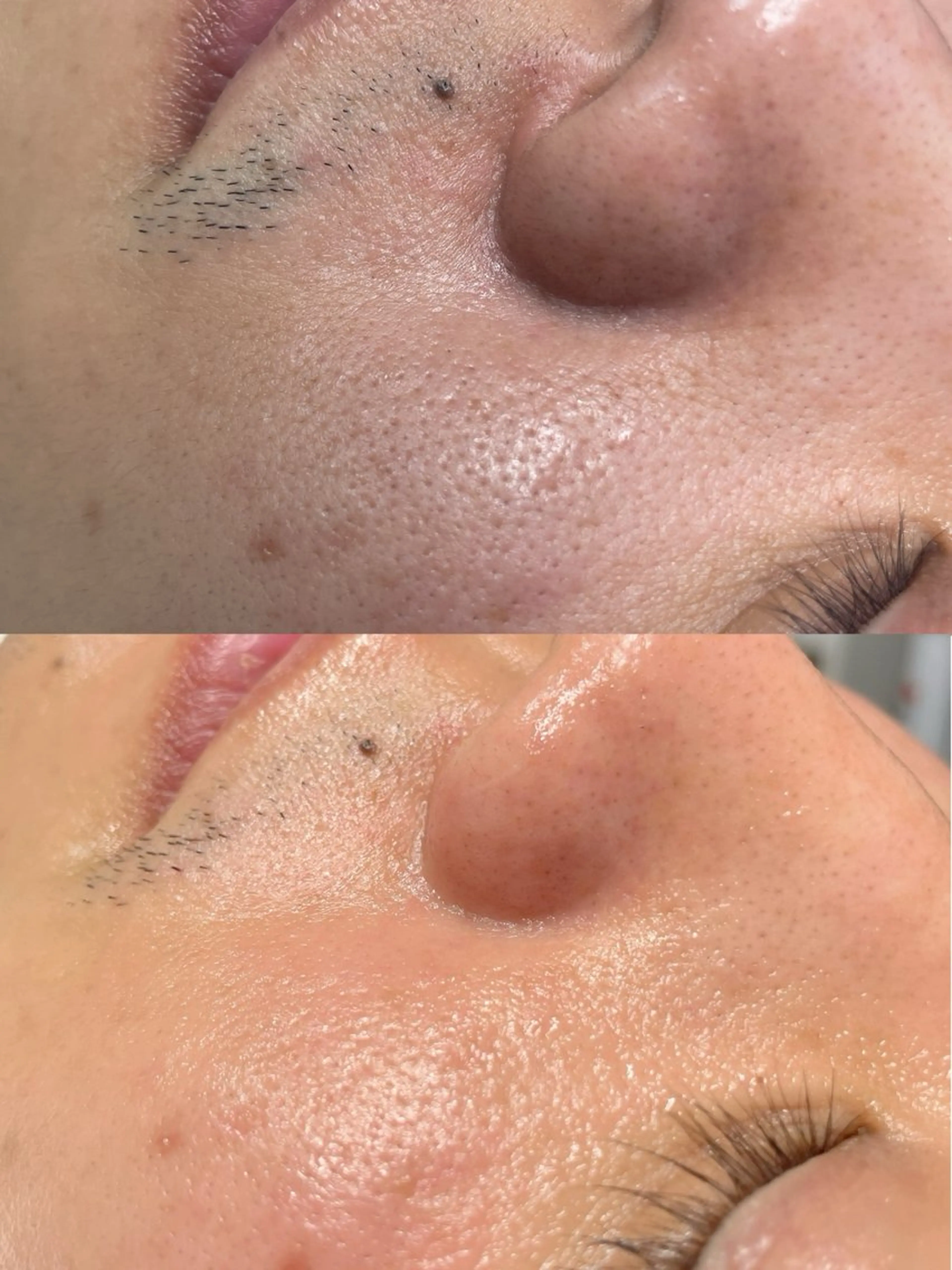 脱毛 ビューティーサロン Lino🫧mayuのエステ・リラクイメージ