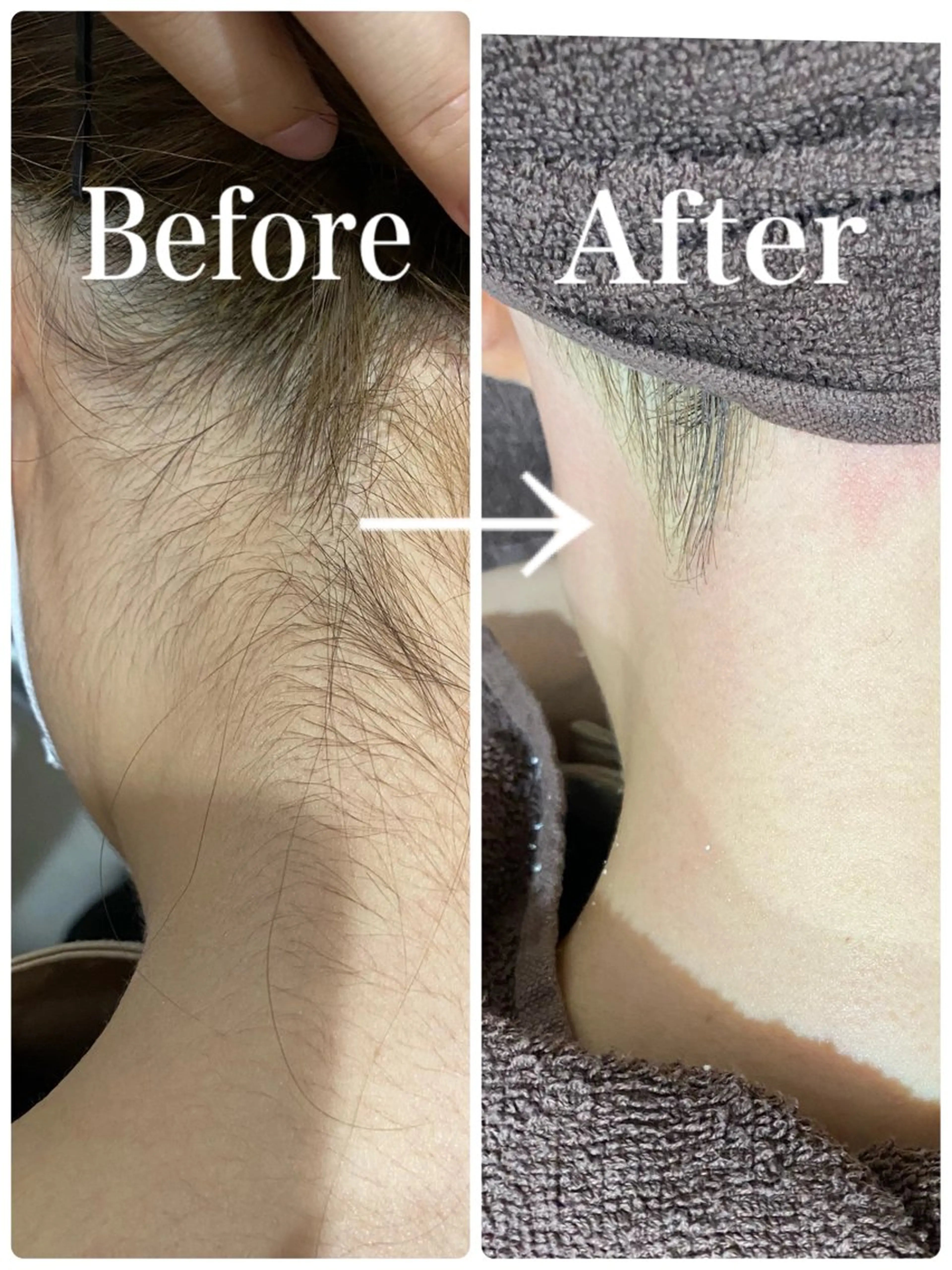 うなじ美人へ✨大人気❤️うなじWax¥4,500→¥3,000の写真