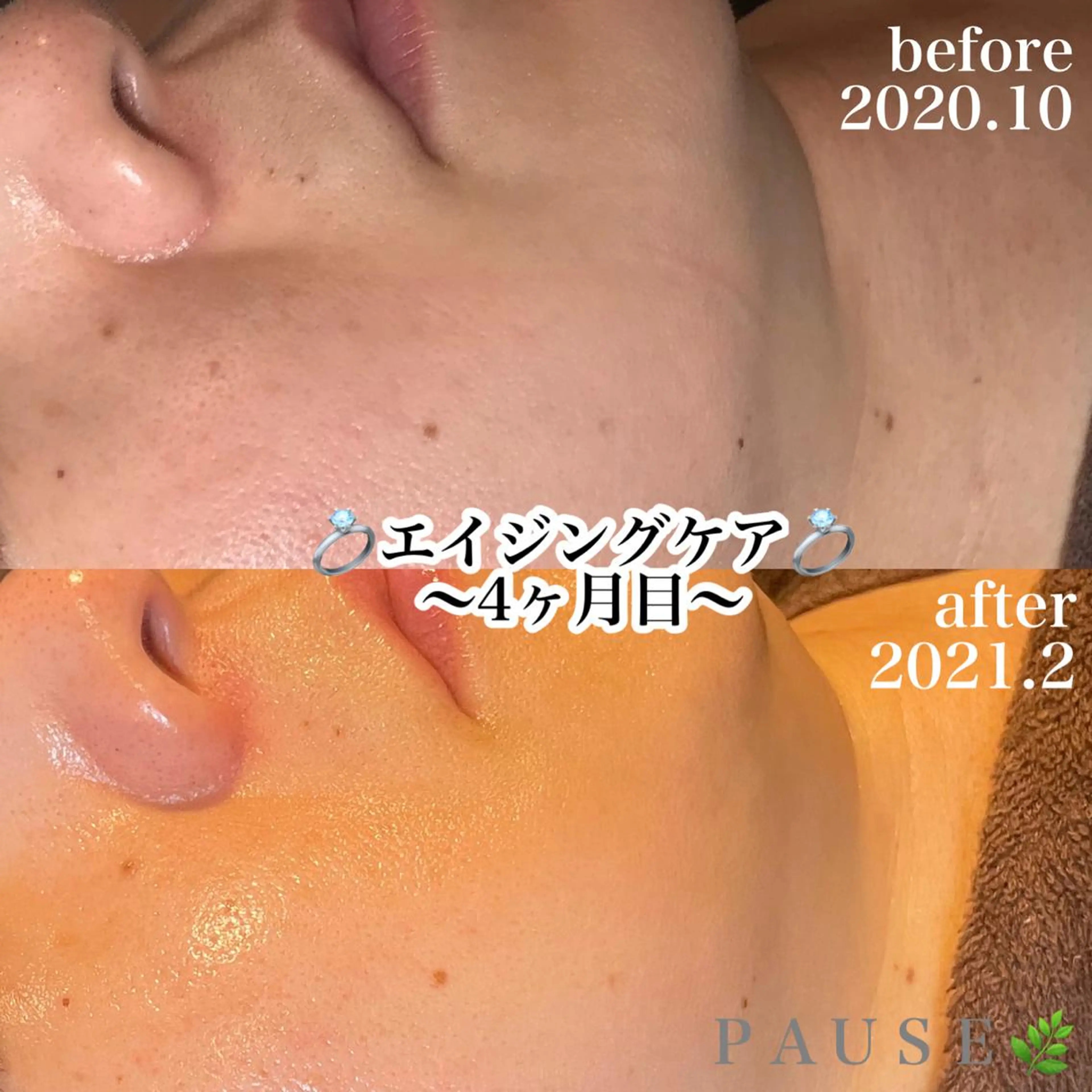 エステ 浜野 恵美のエステ・リラクイメージ