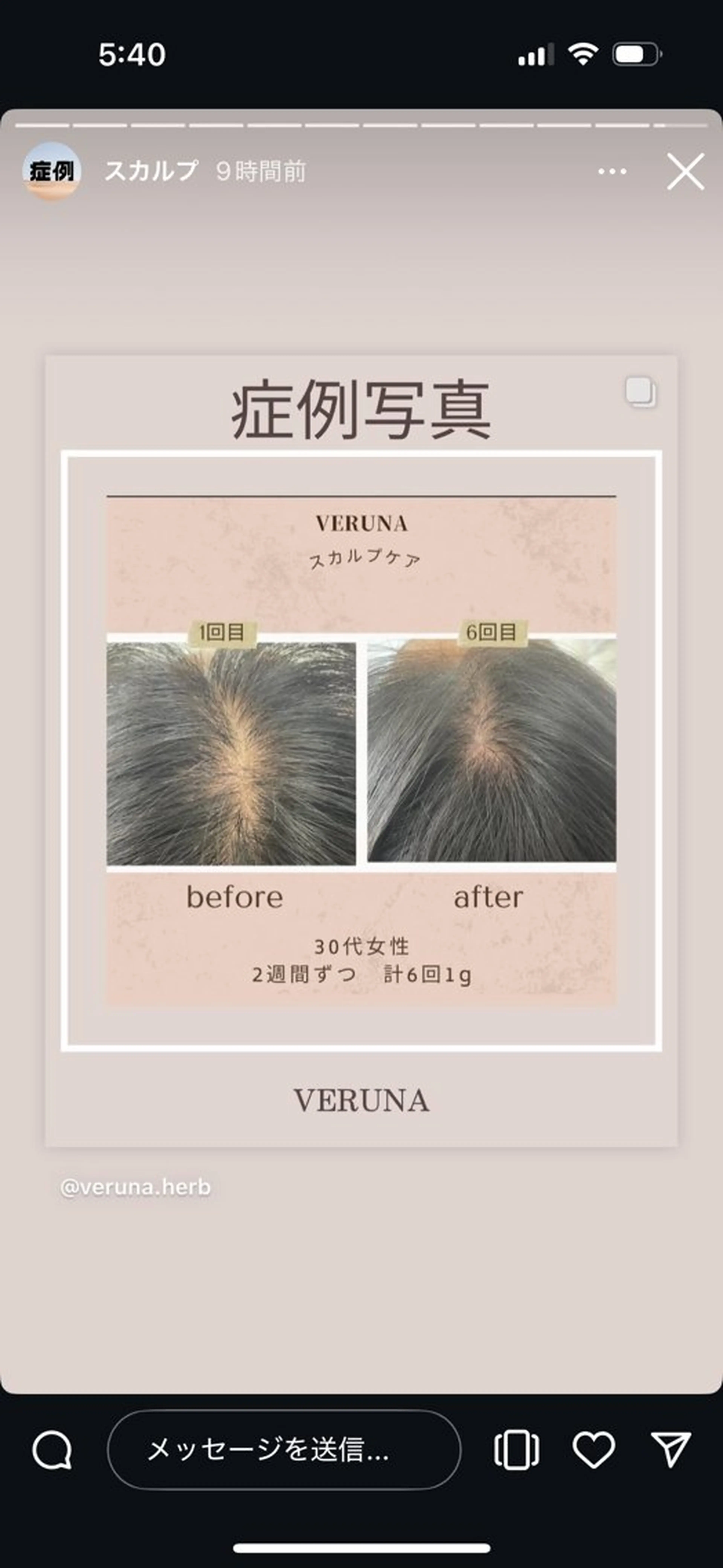 メンズ Grandir所属・ハーブピーリング専門 グランディール　武内のエステ・リラクイメージ