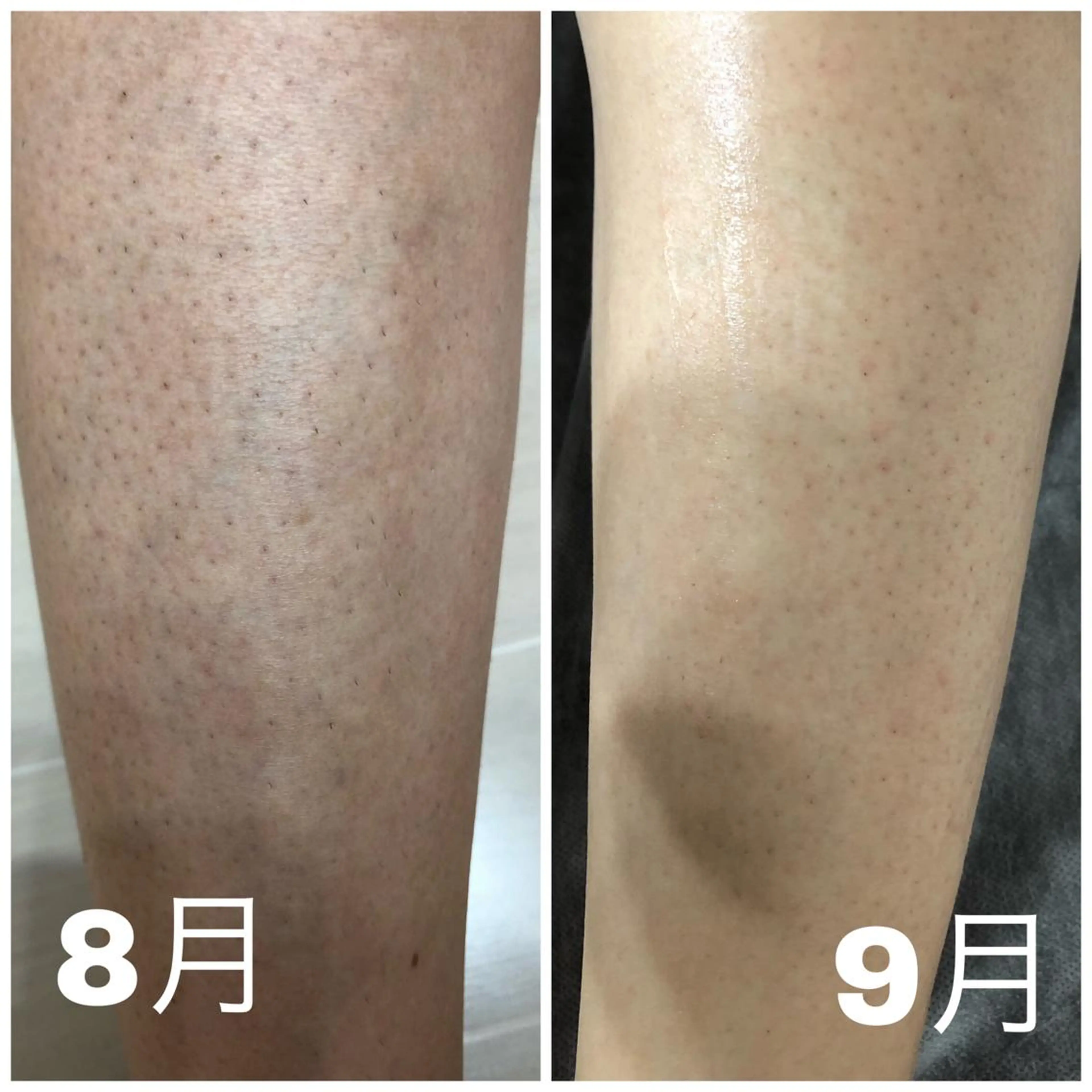 CHERIMO【lalaLaLa】所属・CHERIMO シェリモのネイルデザイン