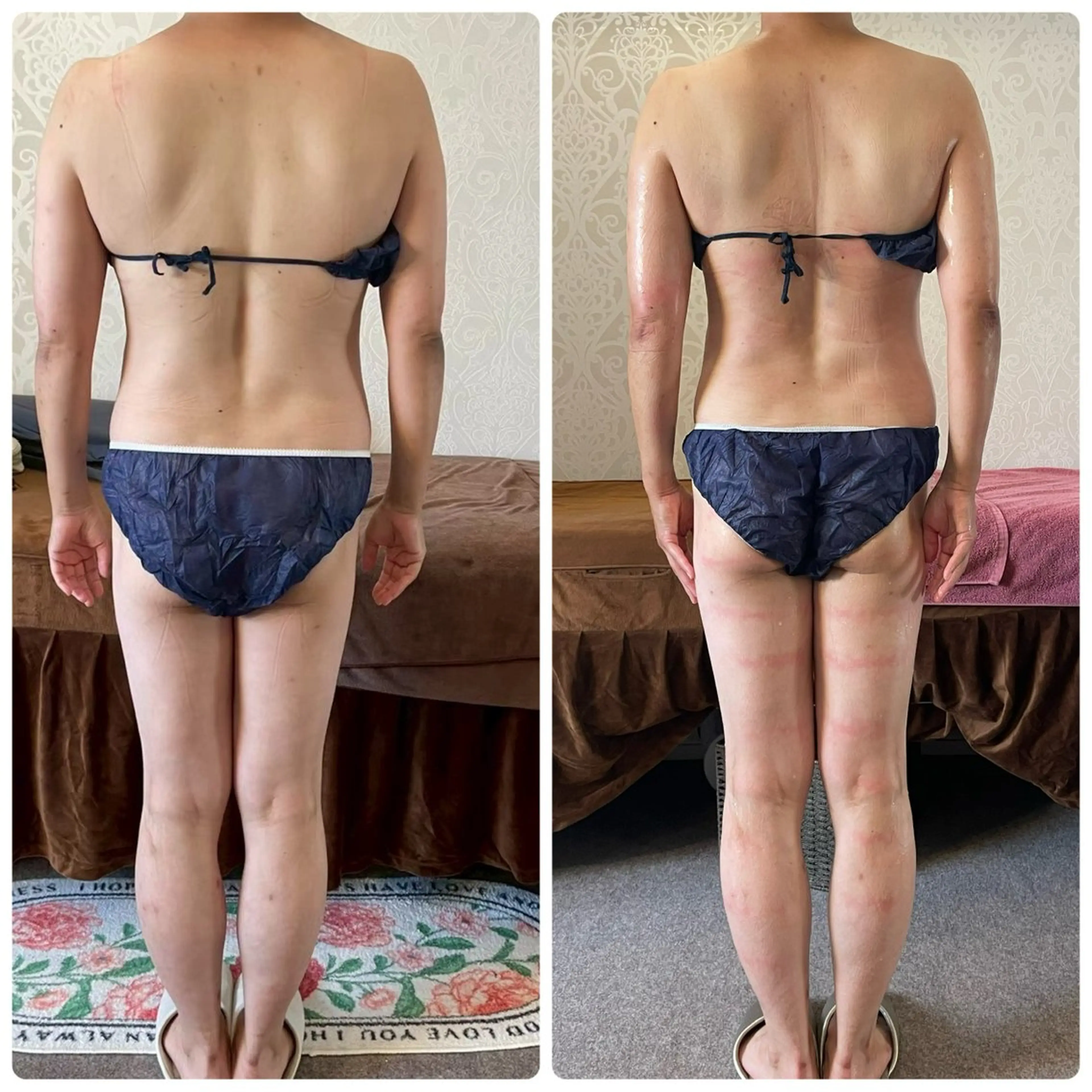 ✩.*極上の˚BODY全身ケア⭐︎美容整体/リンパ/ラジオ派/キャビテーションフルコース❤️の写真