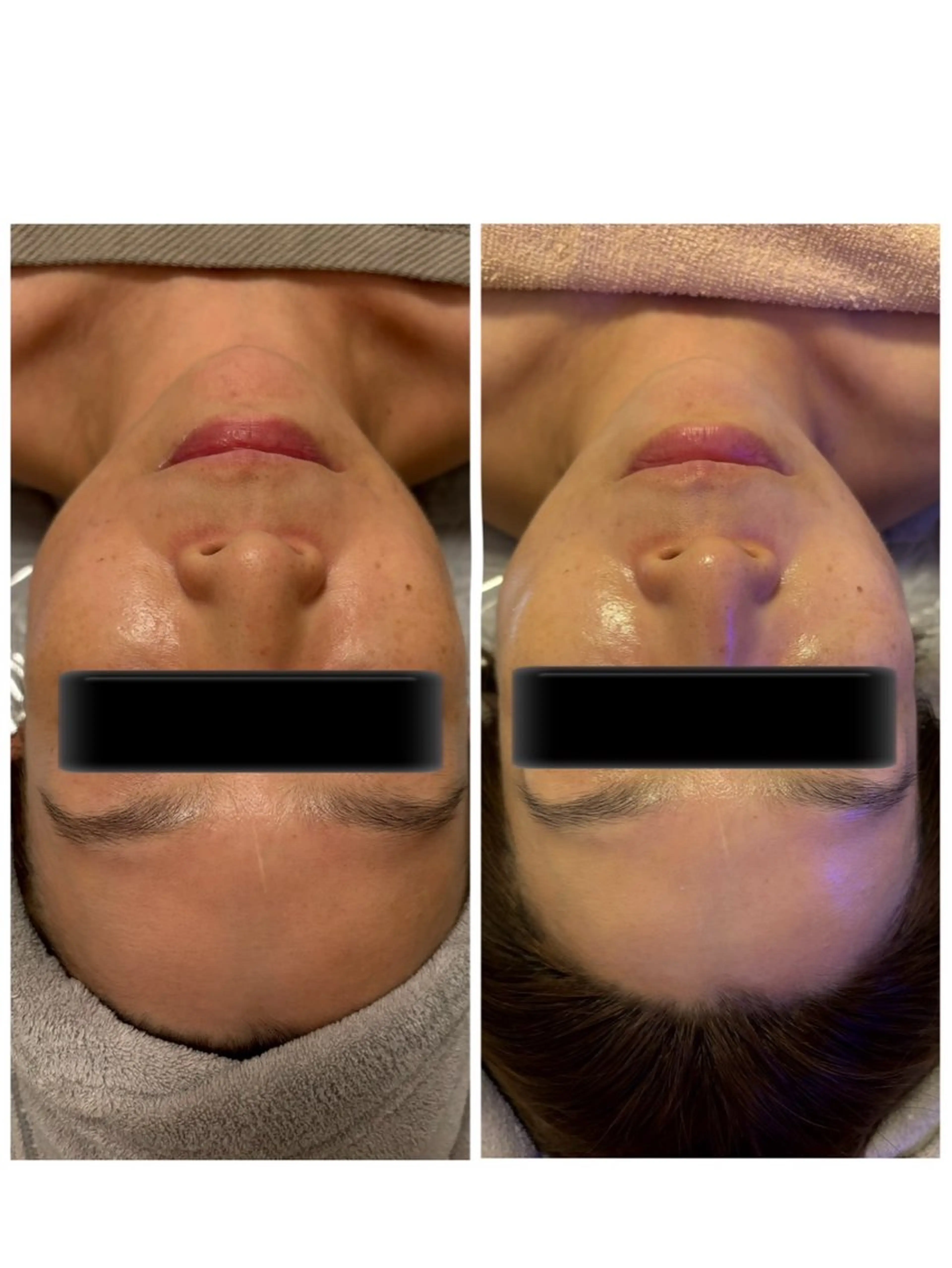 首、肩もしっかりケア⭐︎韓国コルギ　80分の写真