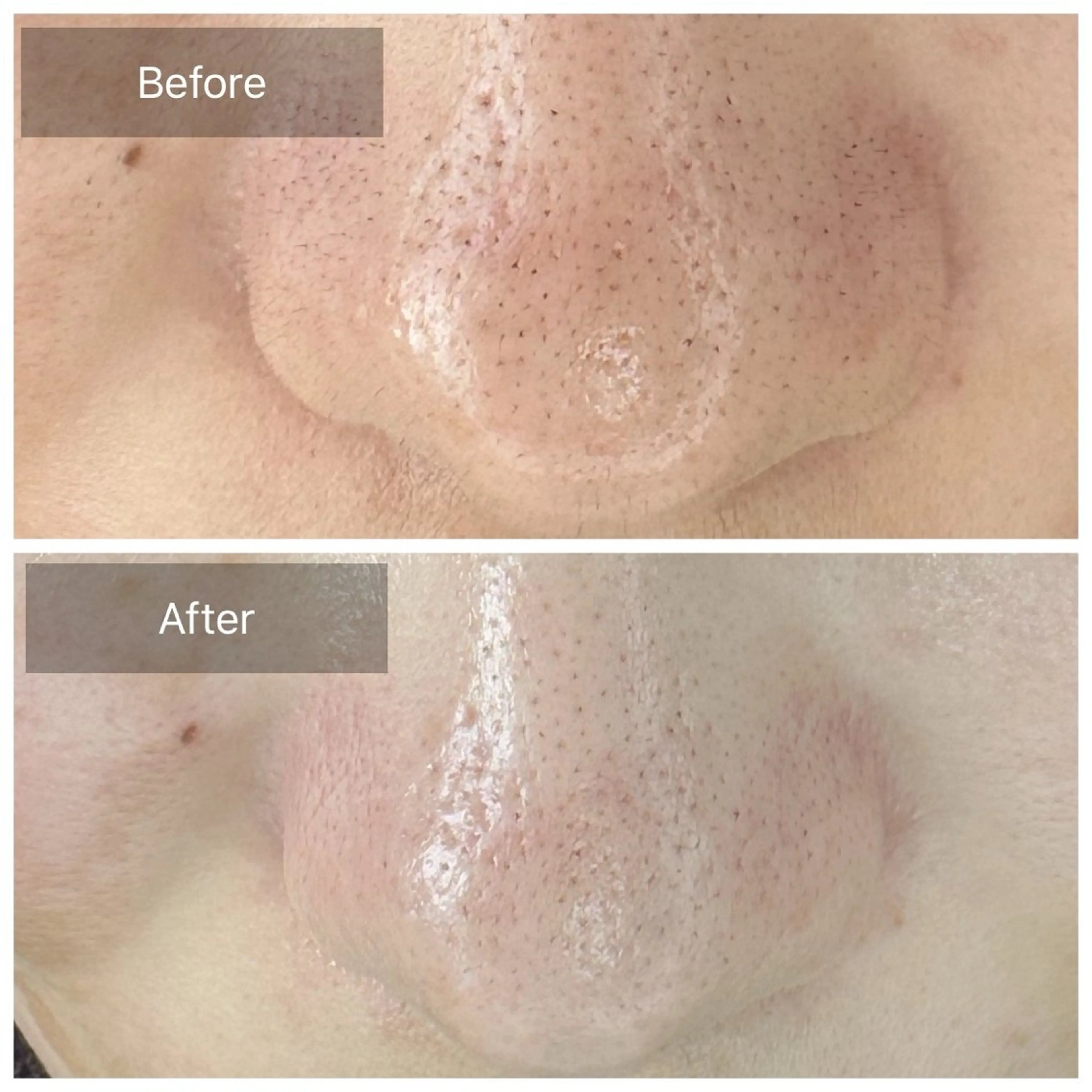 脱毛 トータルしみケア専門 NICA(ニカ)のエステ・リラクイメージ