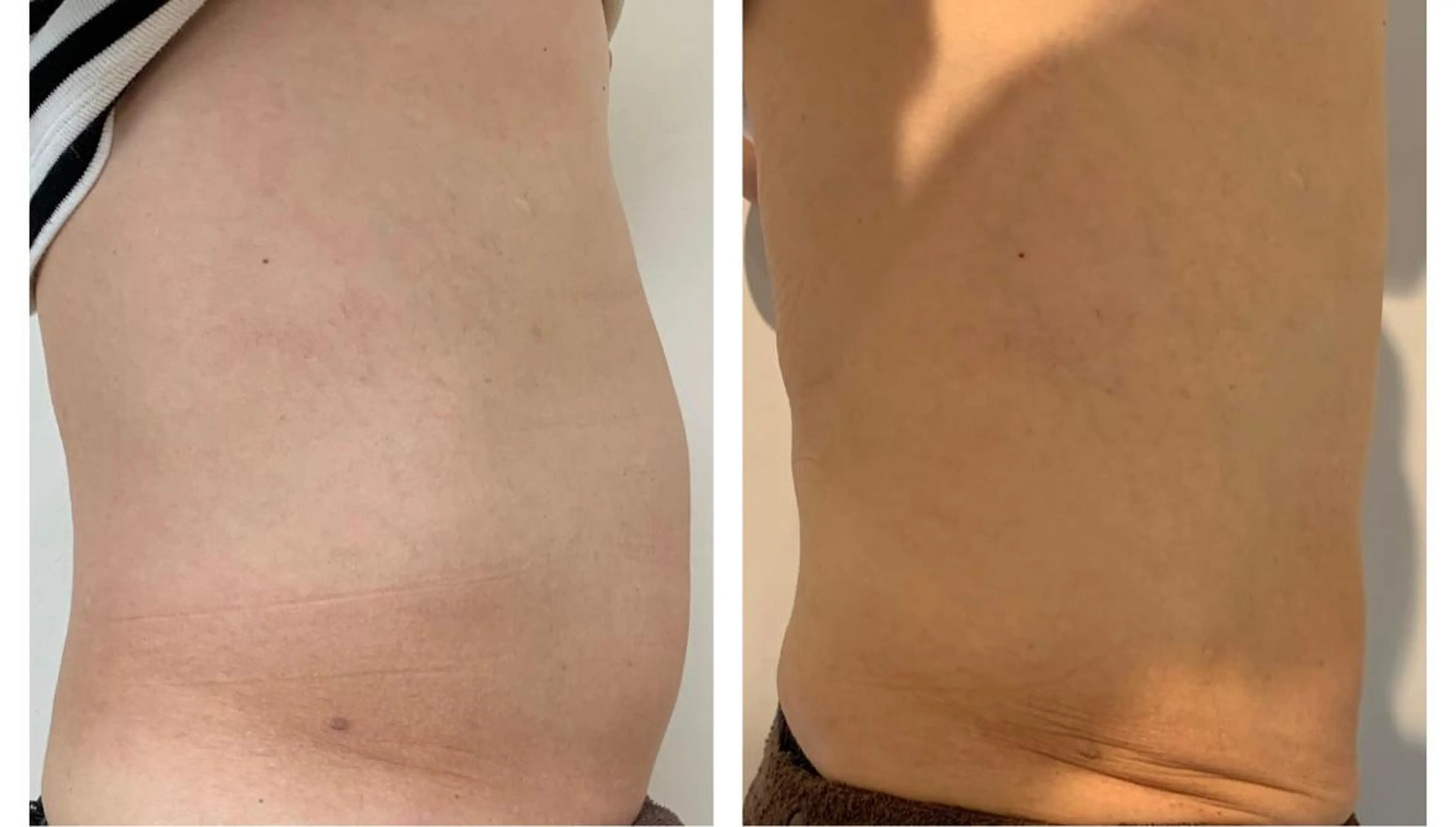 エステ 癒し腸もみサロン シャユーム　ゆきなのエステ・リラクイメージ