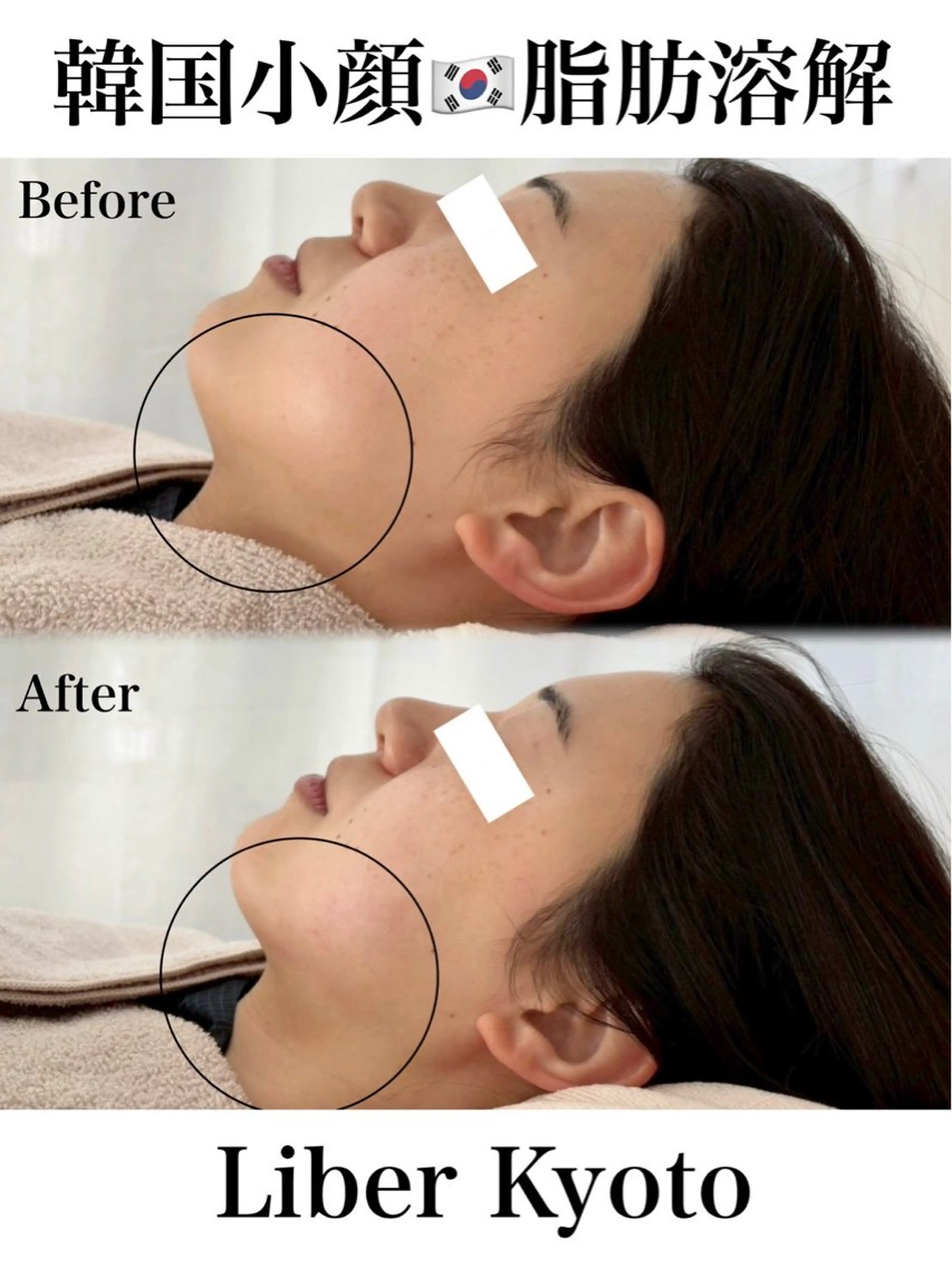 エステ Liber【リベル】 AYAKAのエステ・リラクイメージ