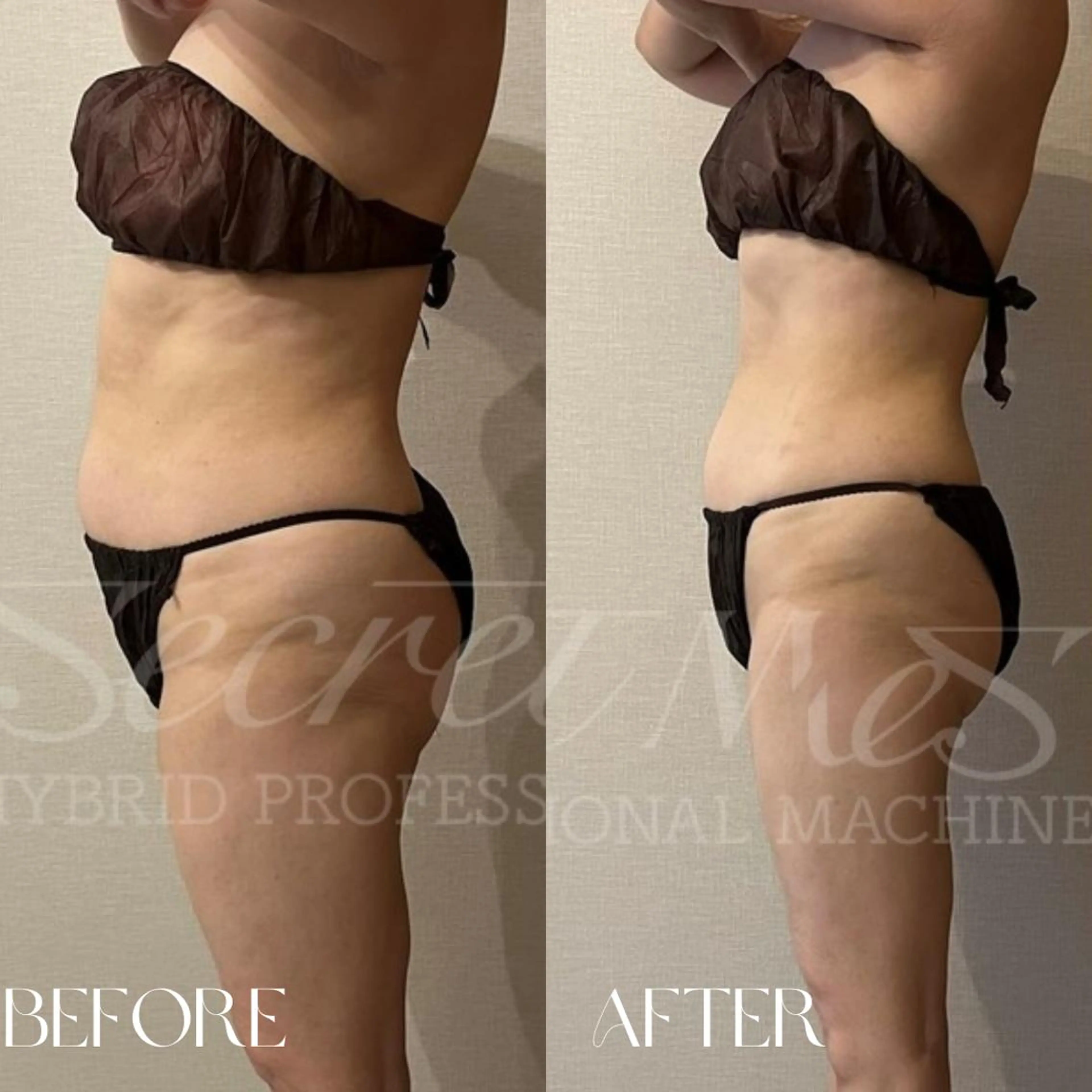 エステ リラク B-st. 下北沢のエステ・リラクイメージ