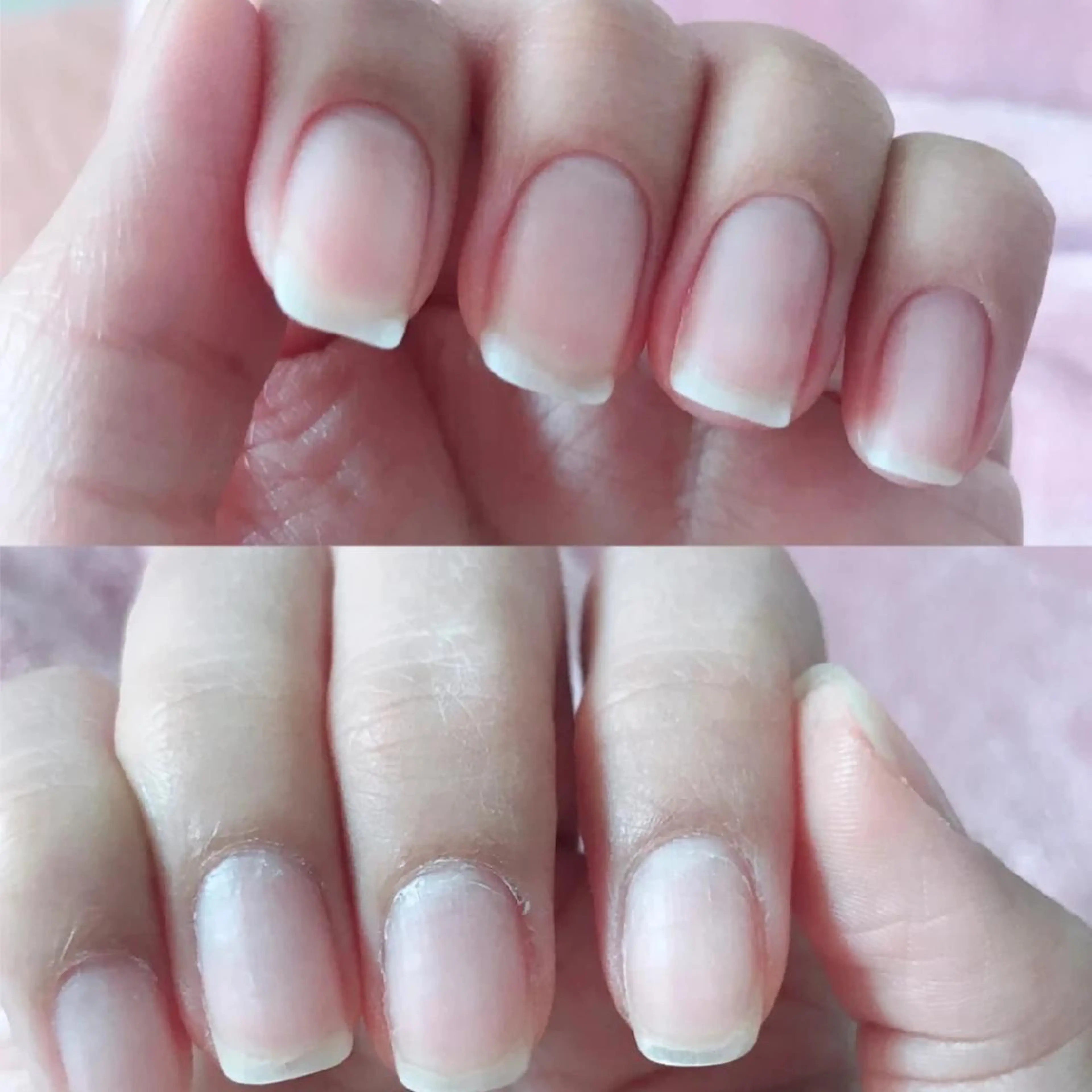 ショート ネイル ネイリストゆか💅 長さだし、深爪矯正のネイルデザイン