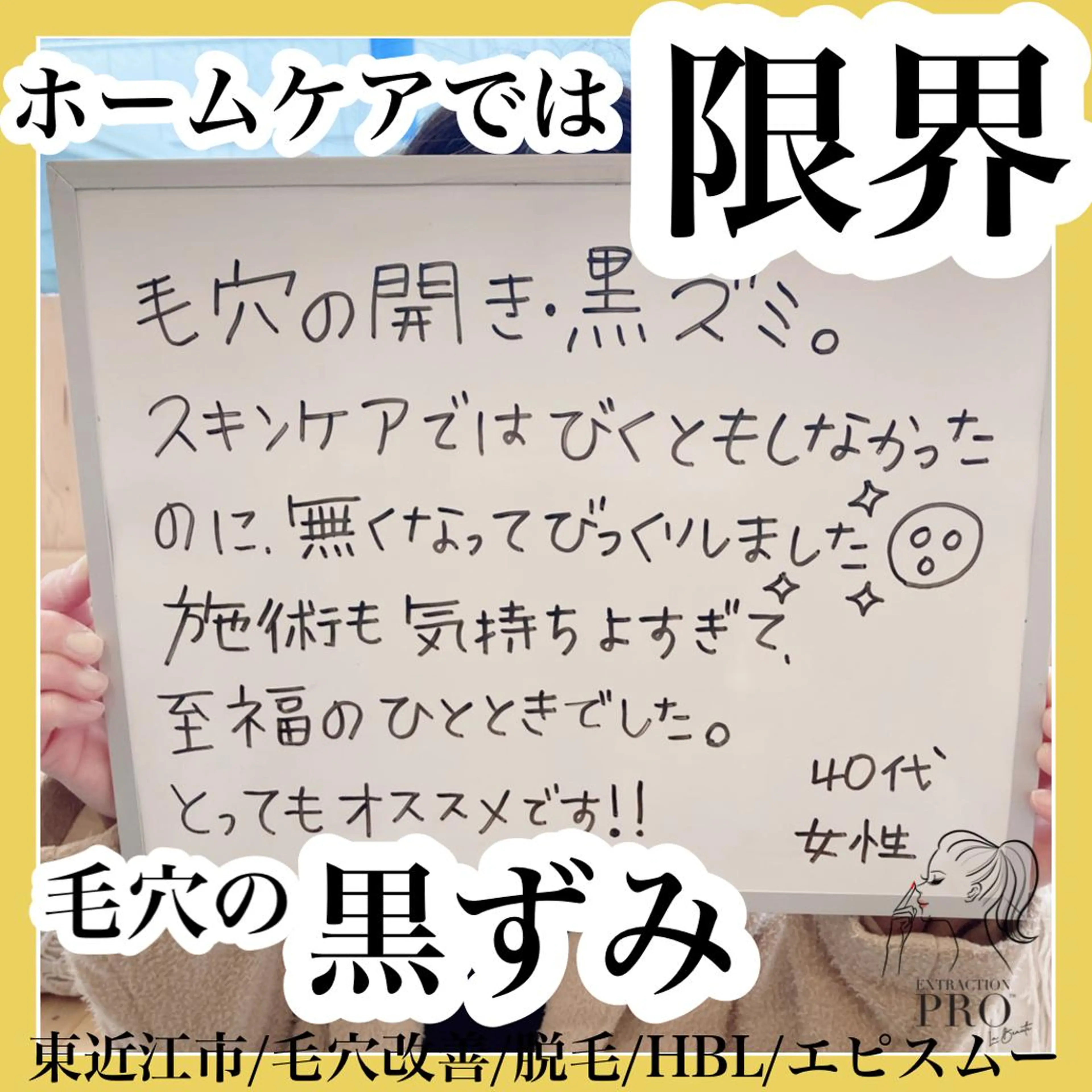 epismoo 脱毛/HBL/毛穴の眉毛・アイブロウイメージ