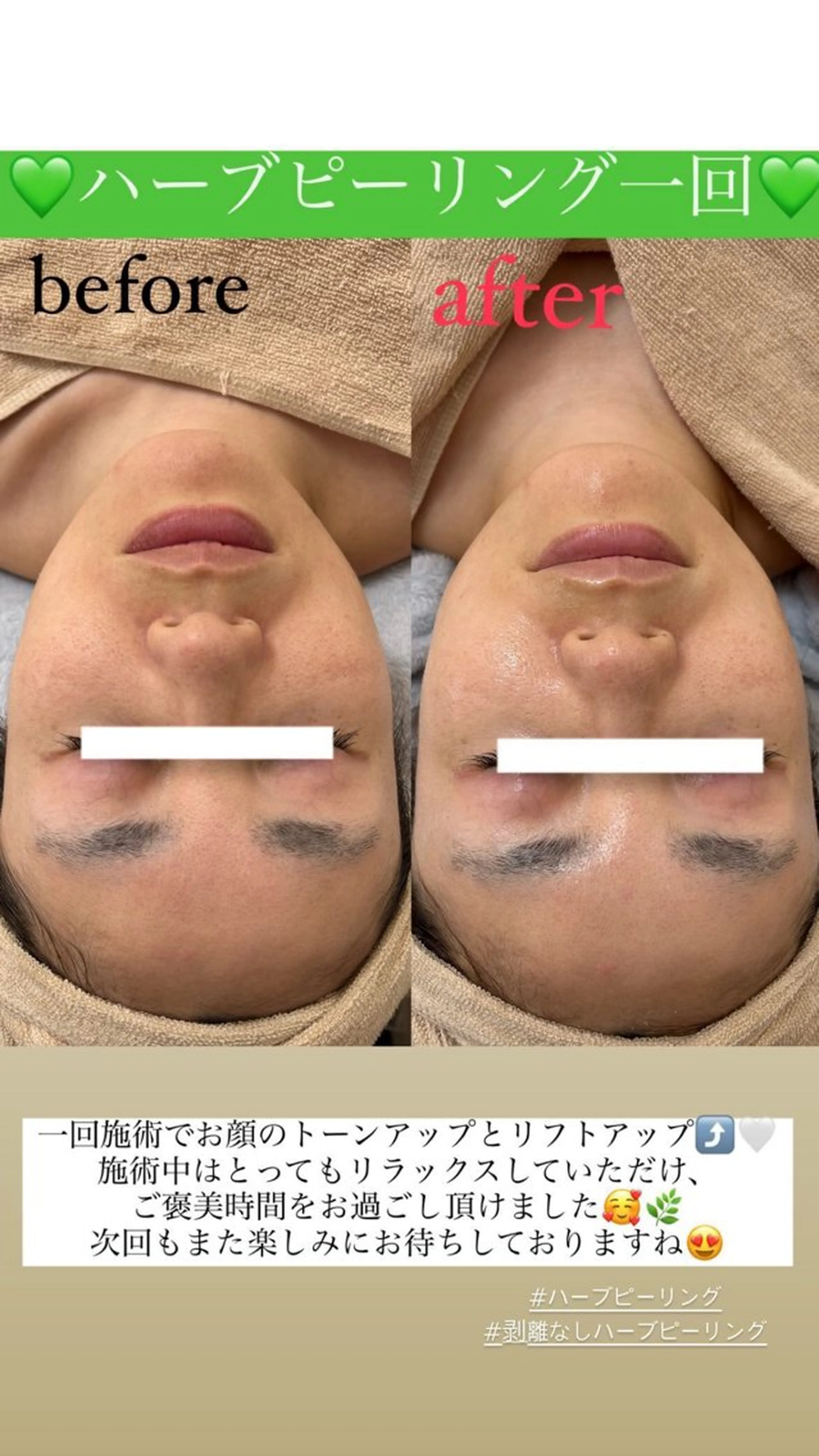 メンズ エステ Salon de Lino 御器所のエステ・リラクイメージ