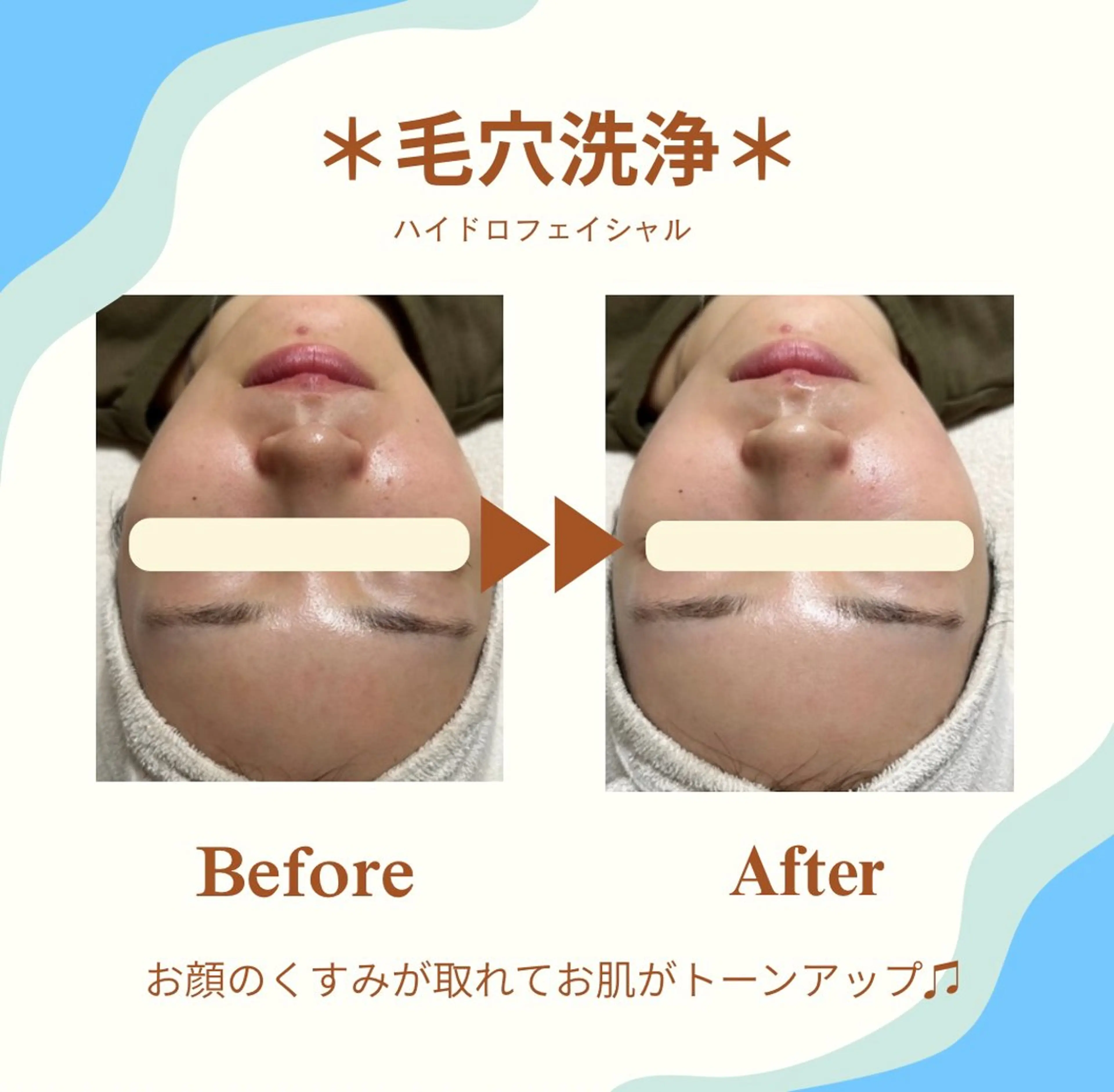 エステ White labo 今村のエステ・リラクイメージ