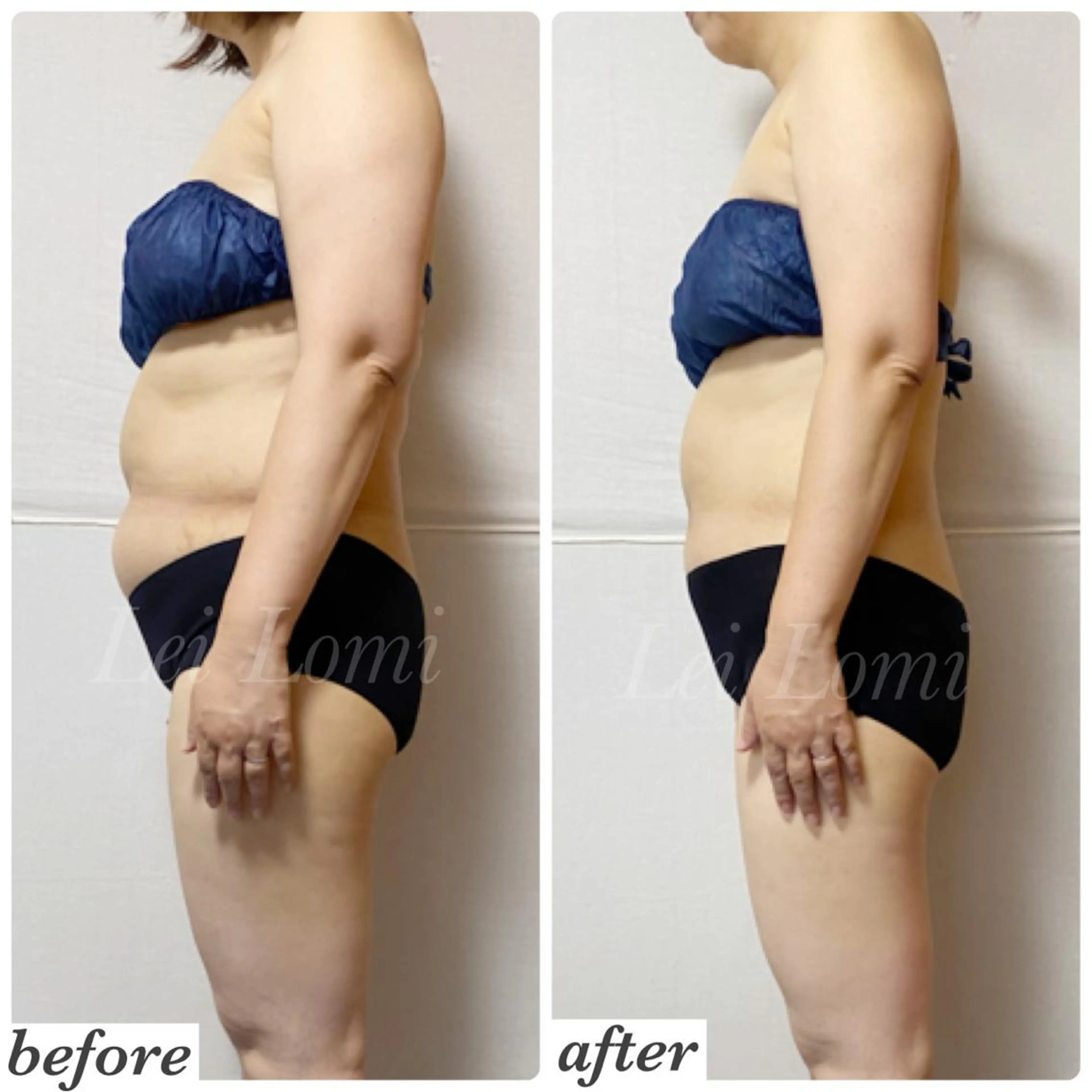 エステ 痩身＆ヘッド 長倉絵美のエステ・リラクイメージ