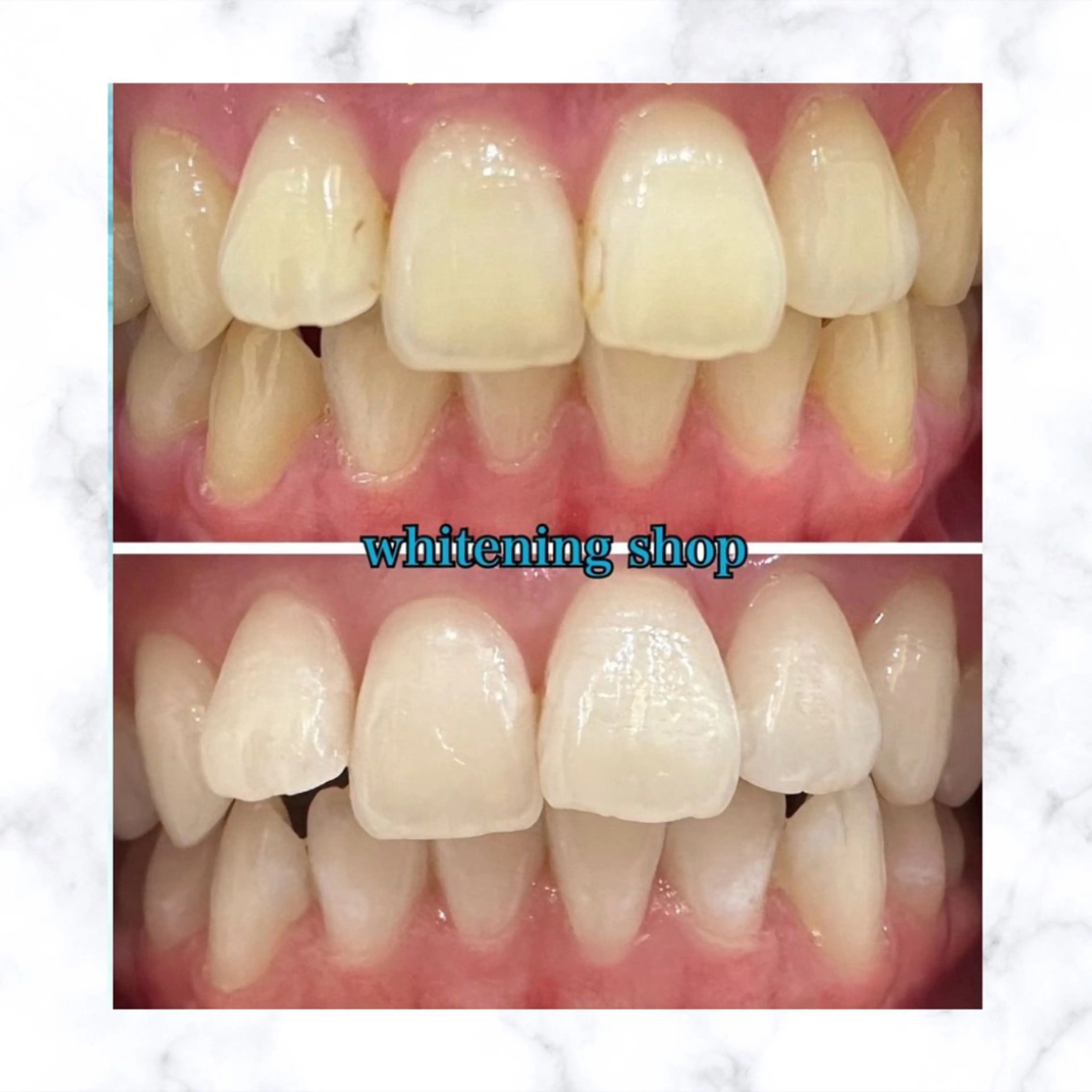 ホワイトニングショップ時津店所属・ホワイトニング ショップ長崎時津店のその他イメージ