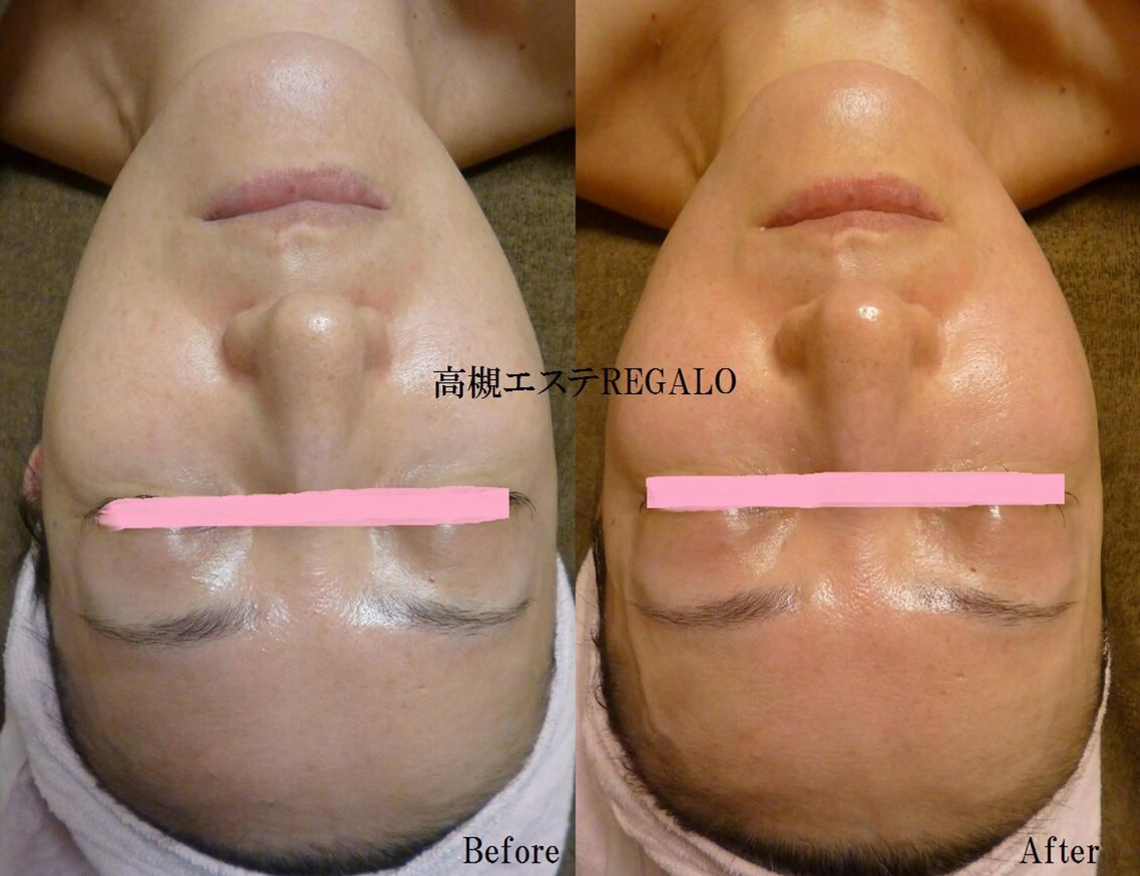 エステ REGALO所属・矢野 さやかのエステ・リラクイメージ