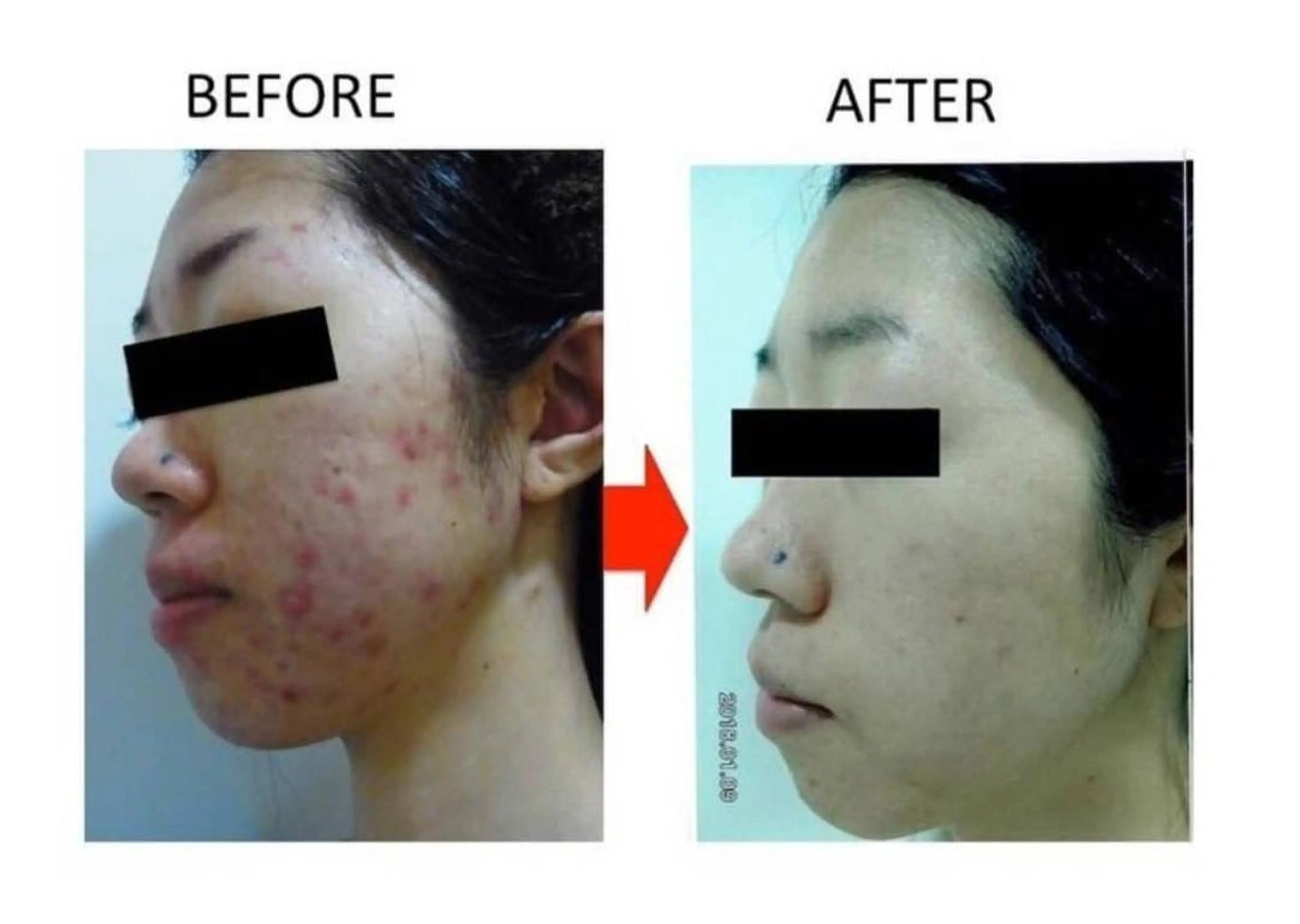 肌質改善専門サロン ／FSS渋谷店　松本のエステ・リラクイメージ