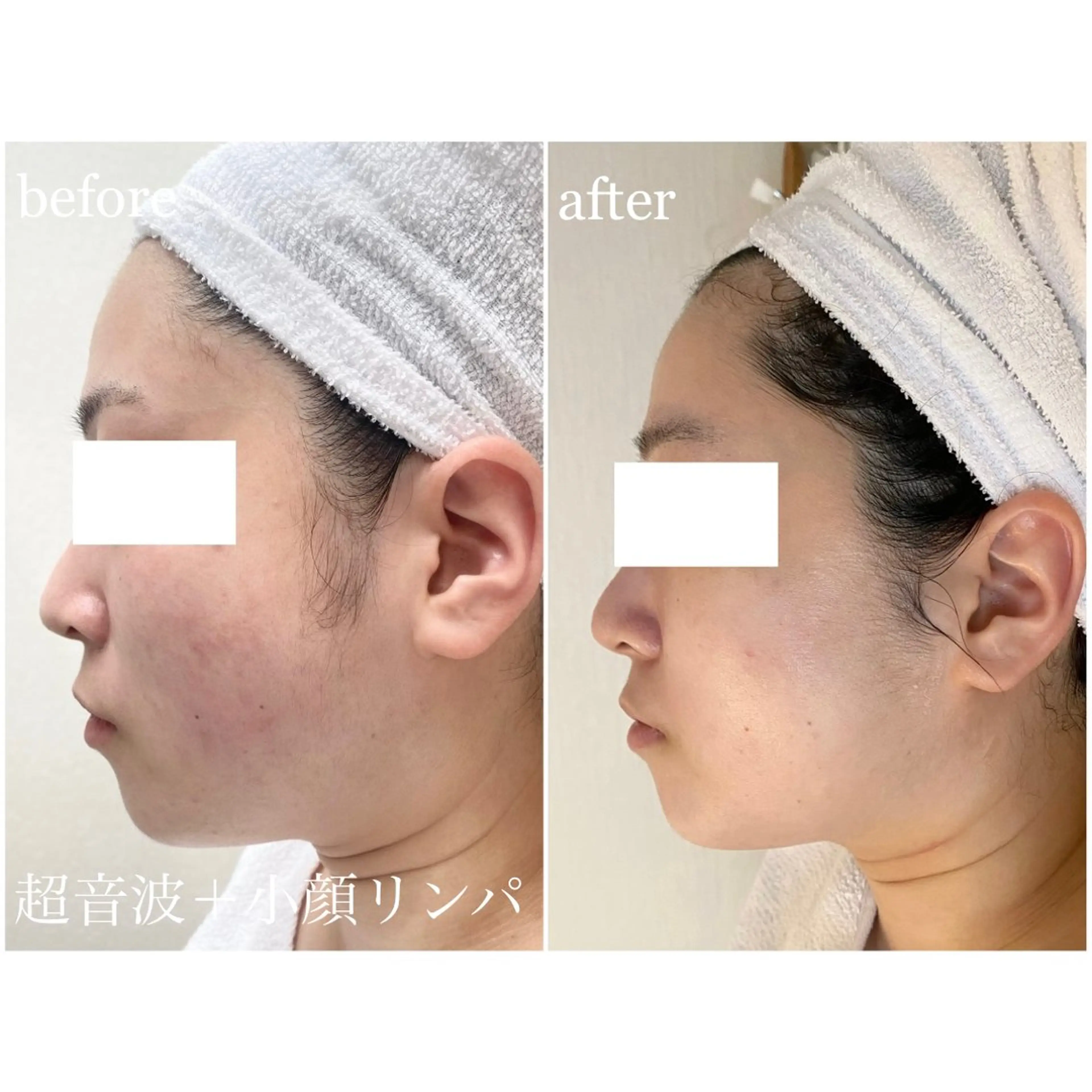 I'm -ｲﾑ-所属・肌質改善／ブライダル I'm.-イム-のエステ・リラクイメージ