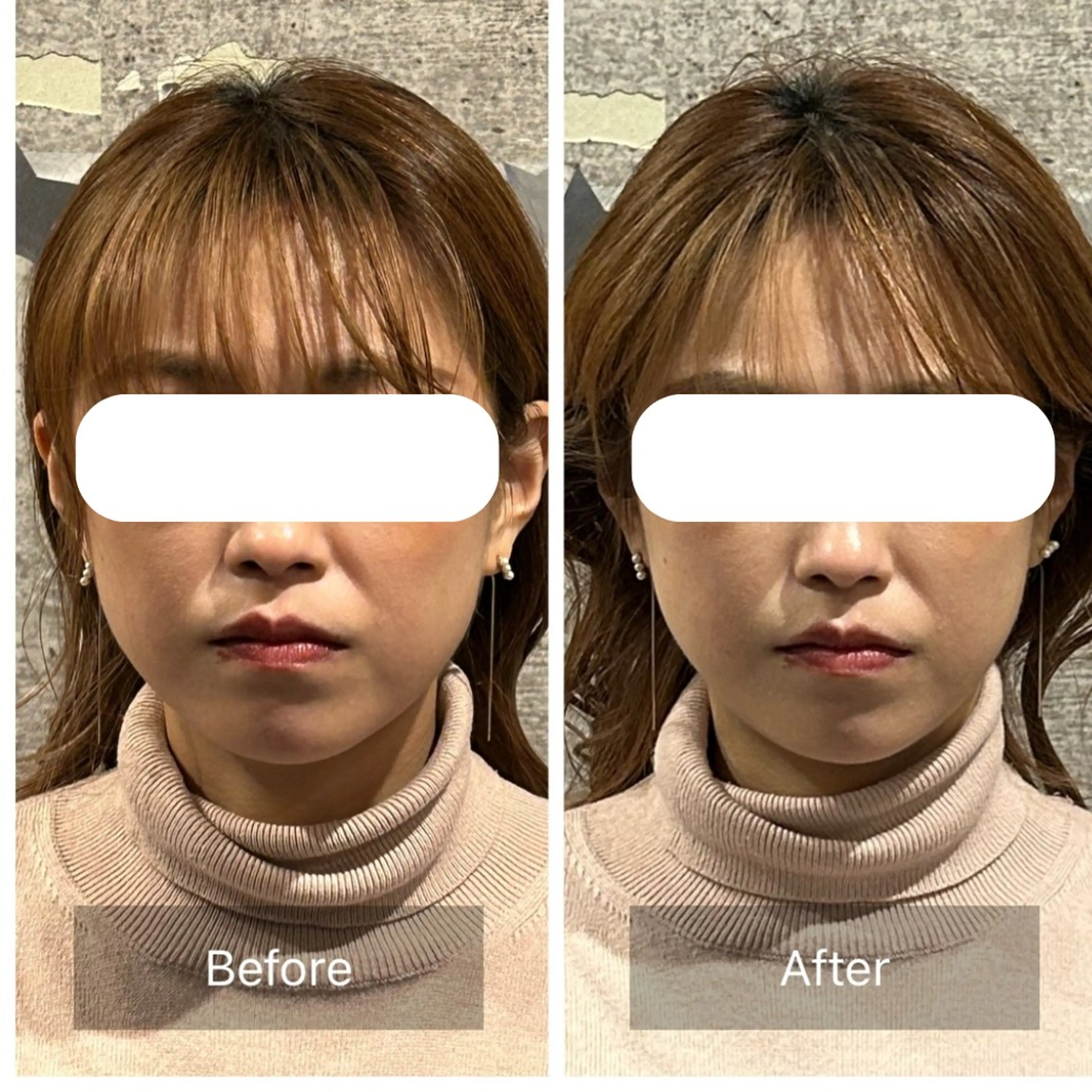 美容整体サロン　アンヨール所属・整体アンヨール 白石のエステ・リラクイメージ