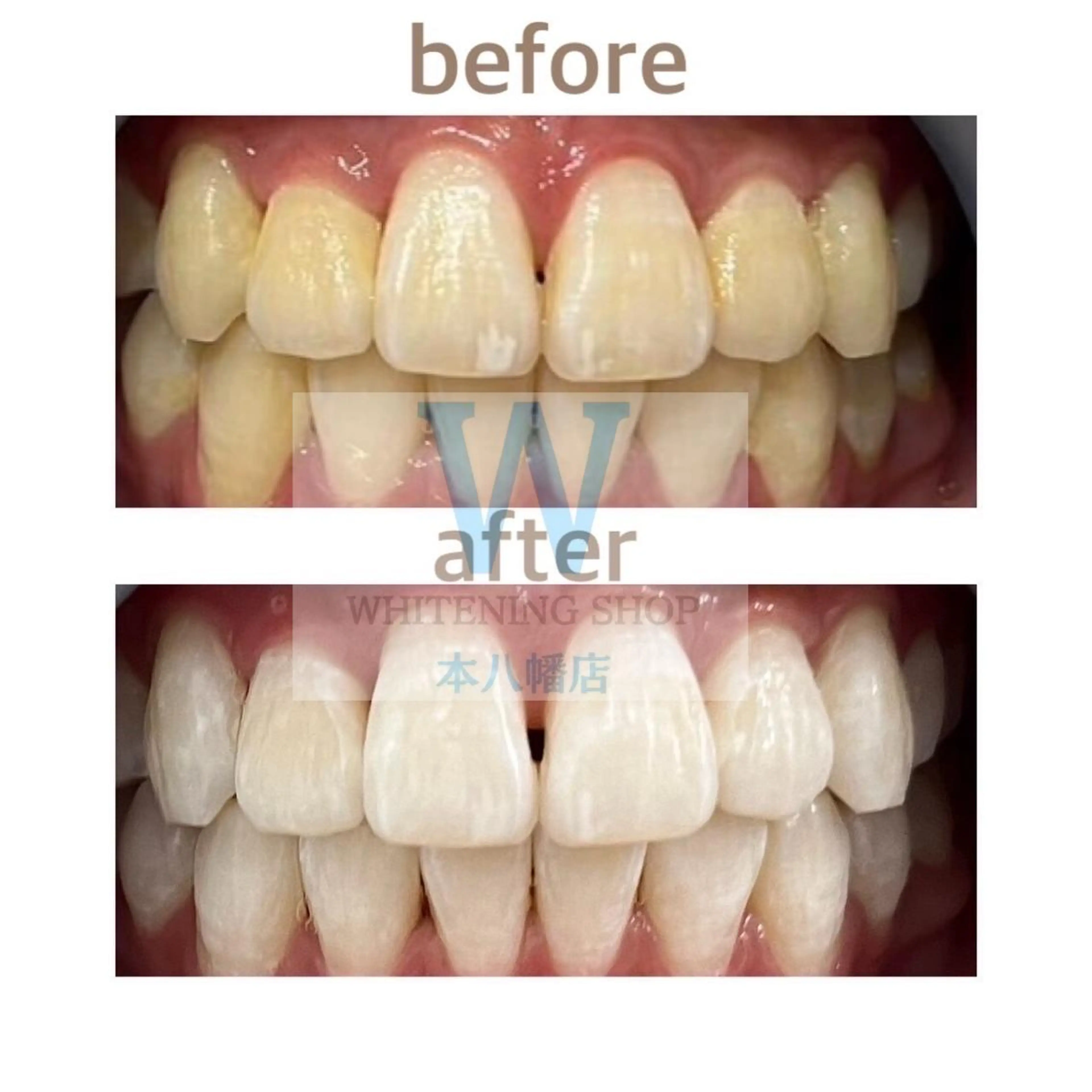 ホワイトニング ショップ本八幡店のエステ・リラクイメージ