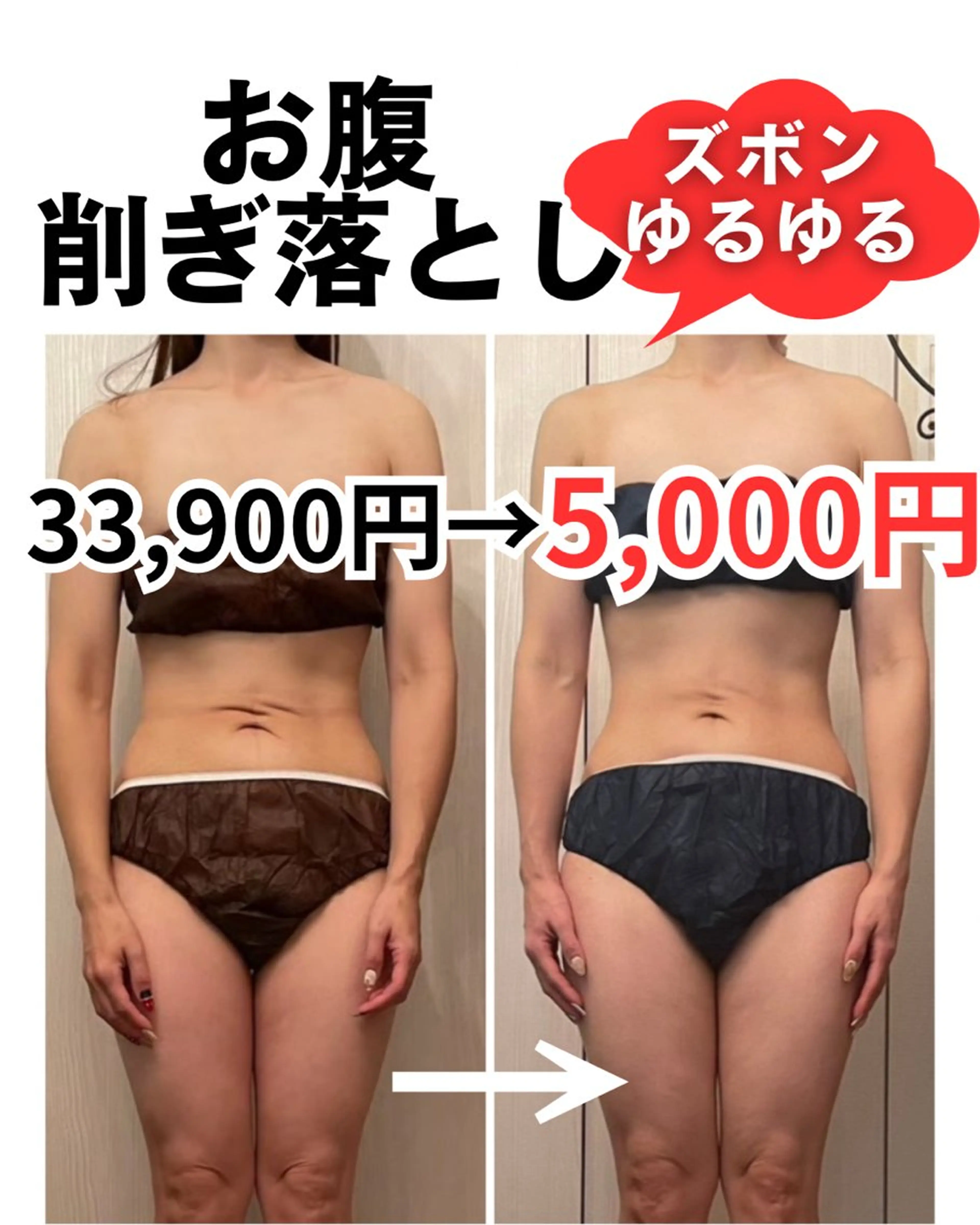 【すぐ予約限定 痩身】くい込み腹、横姿スッキリ60分の写真