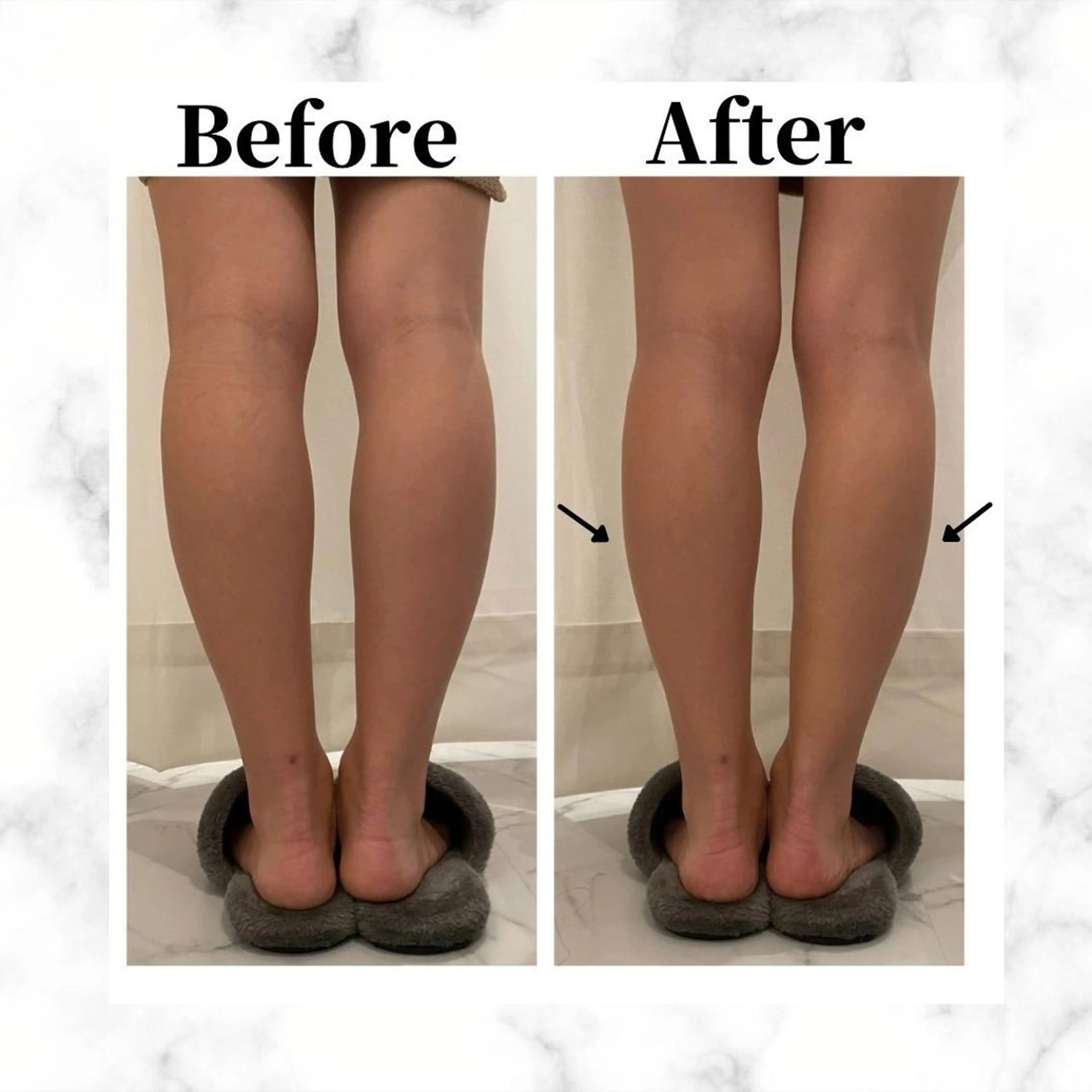 エステ リラク 12Dハイフ💗 最強小顔のエステ・リラクイメージ