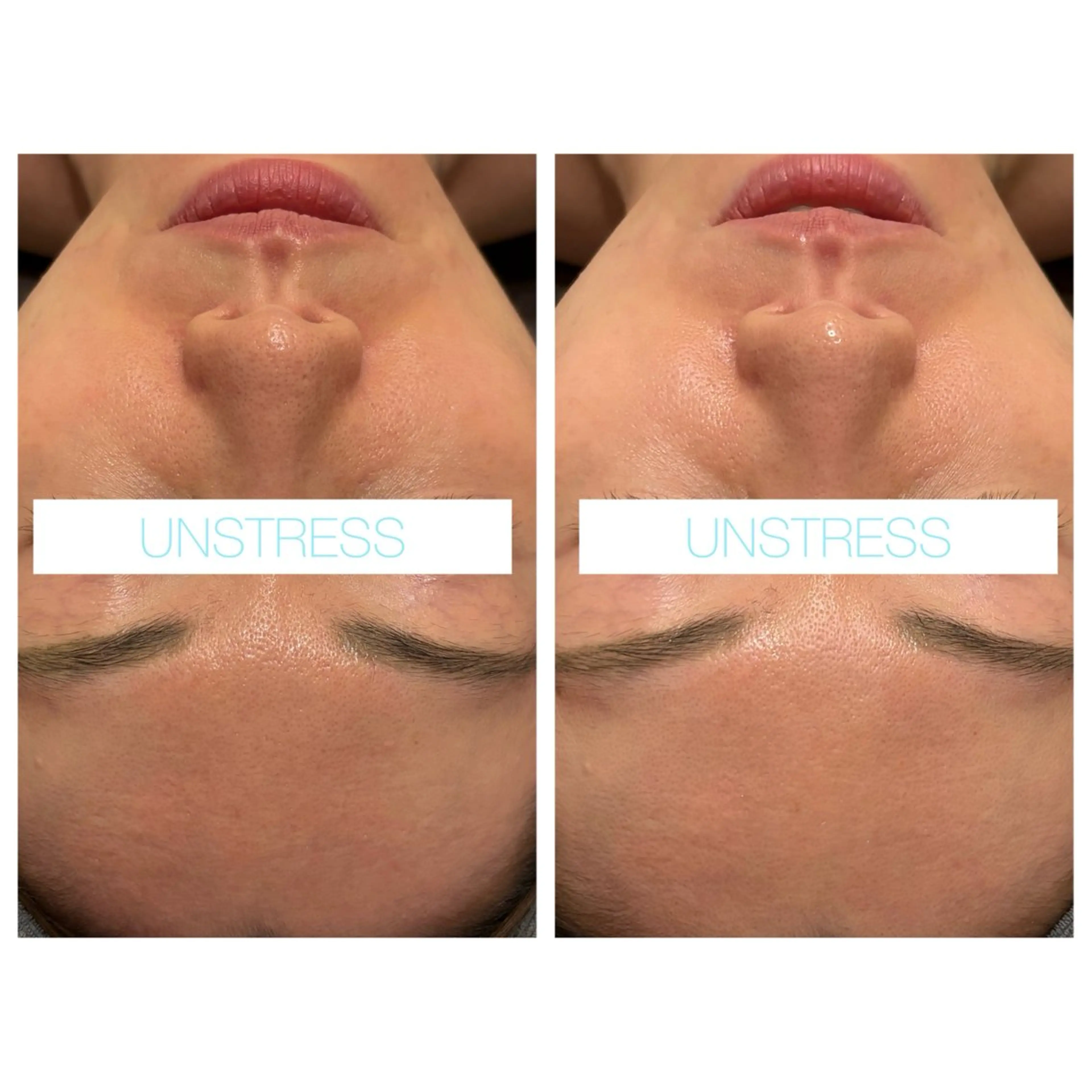 エステ ☆痩身/小顔☆ 結果出します☆のエステ・リラクイメージ