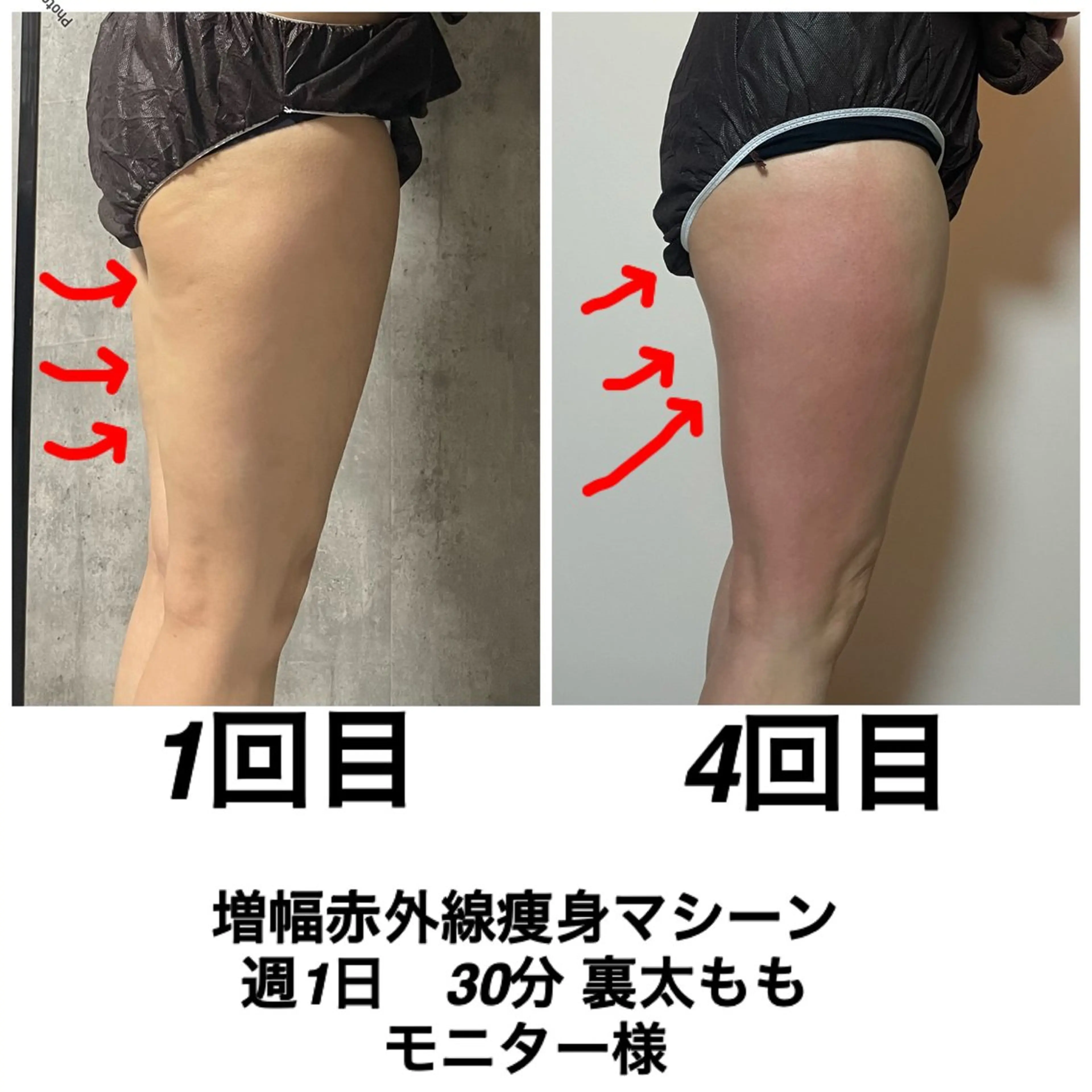 ネイル・エステサロンUILANI所属・ネイル・エステサロン UILANIのネイルデザイン