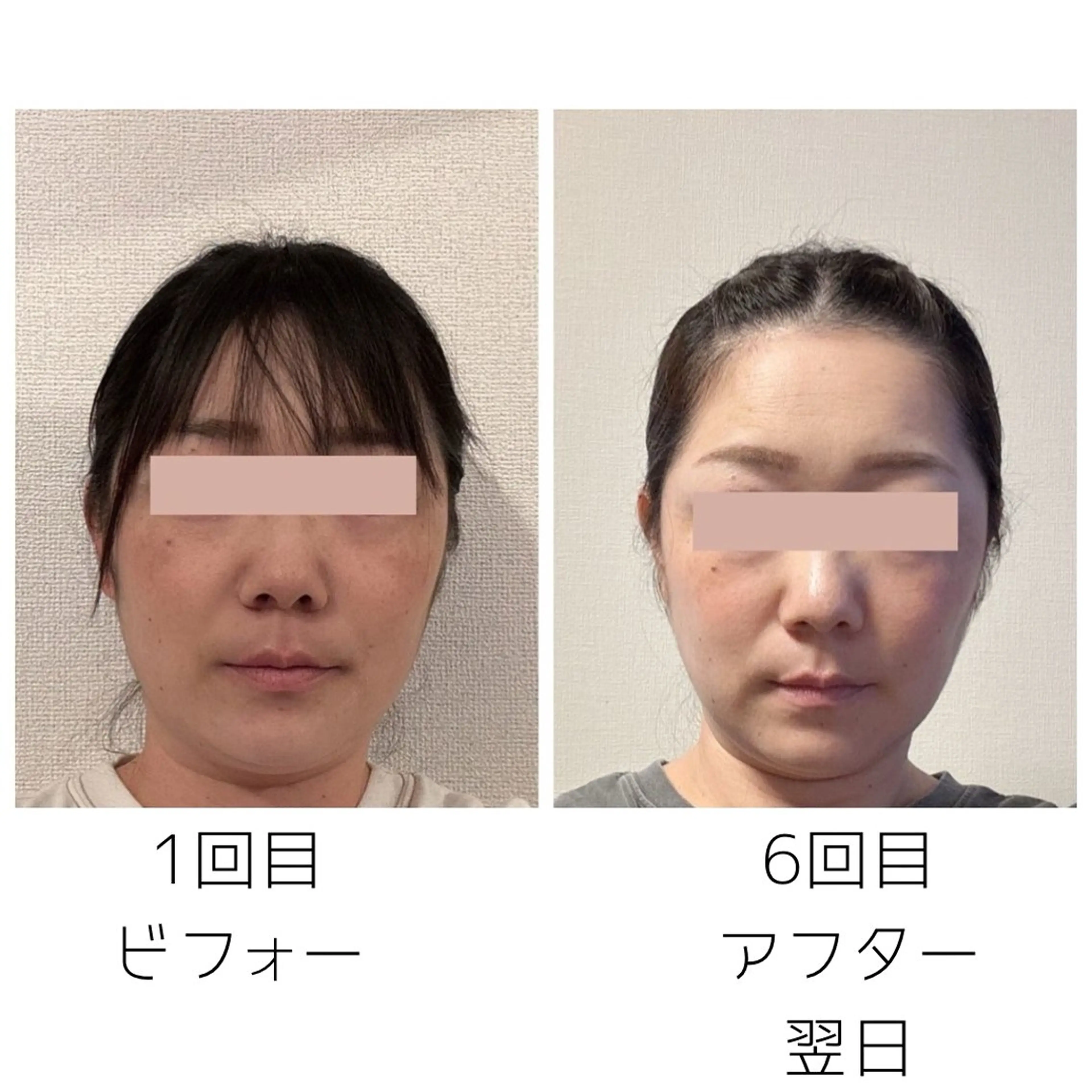 晴れ晴れ 整体院のエステ・リラクイメージ