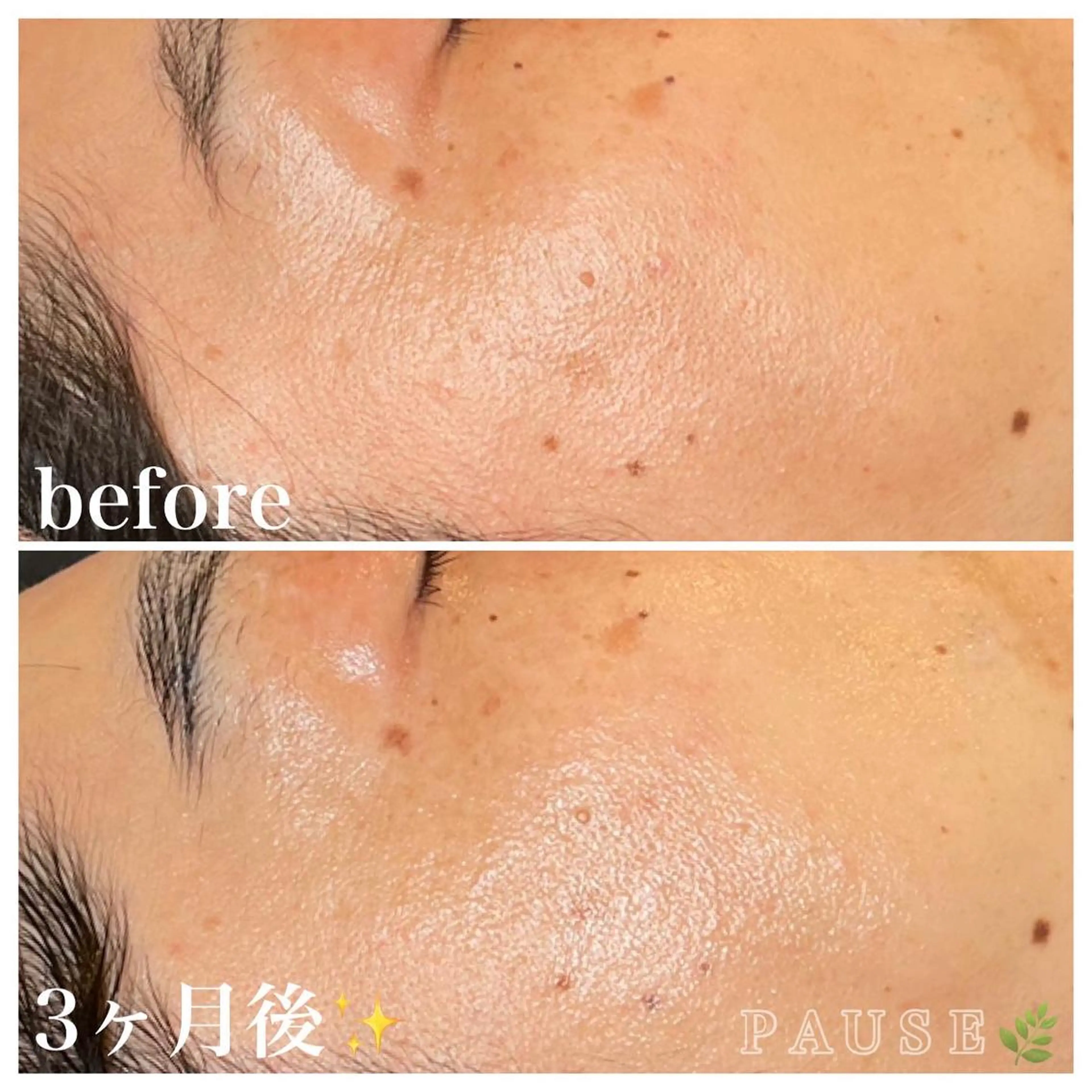 エステ 浜野 恵美のエステ・リラクイメージ