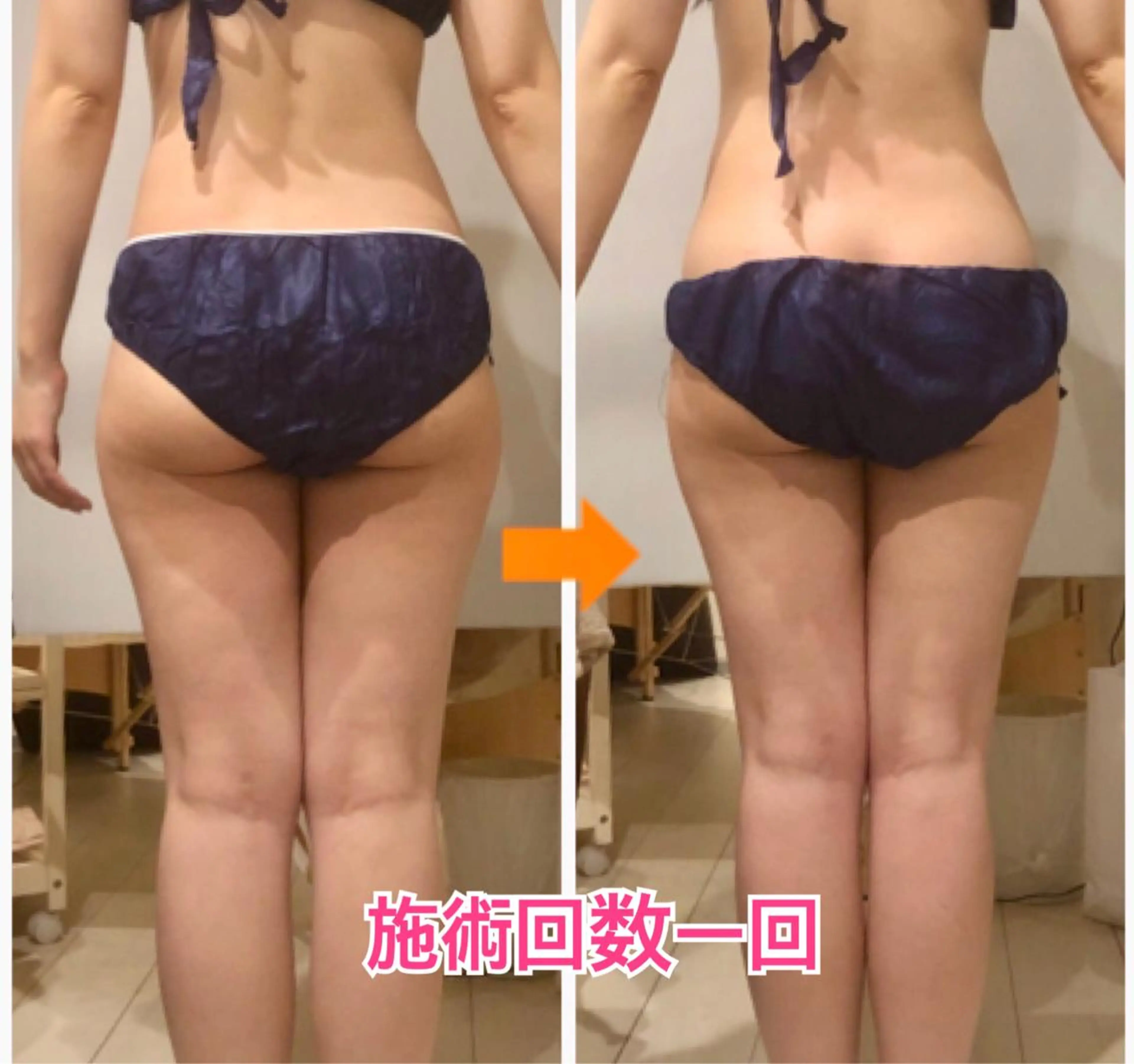 ロング カラー パーマ ヘアアレンジ メンズ キッズ ネイル マツエク・マツパ ‍痩身＆ボディ 結果出し🌟丹野のエステ・リラクイメージ