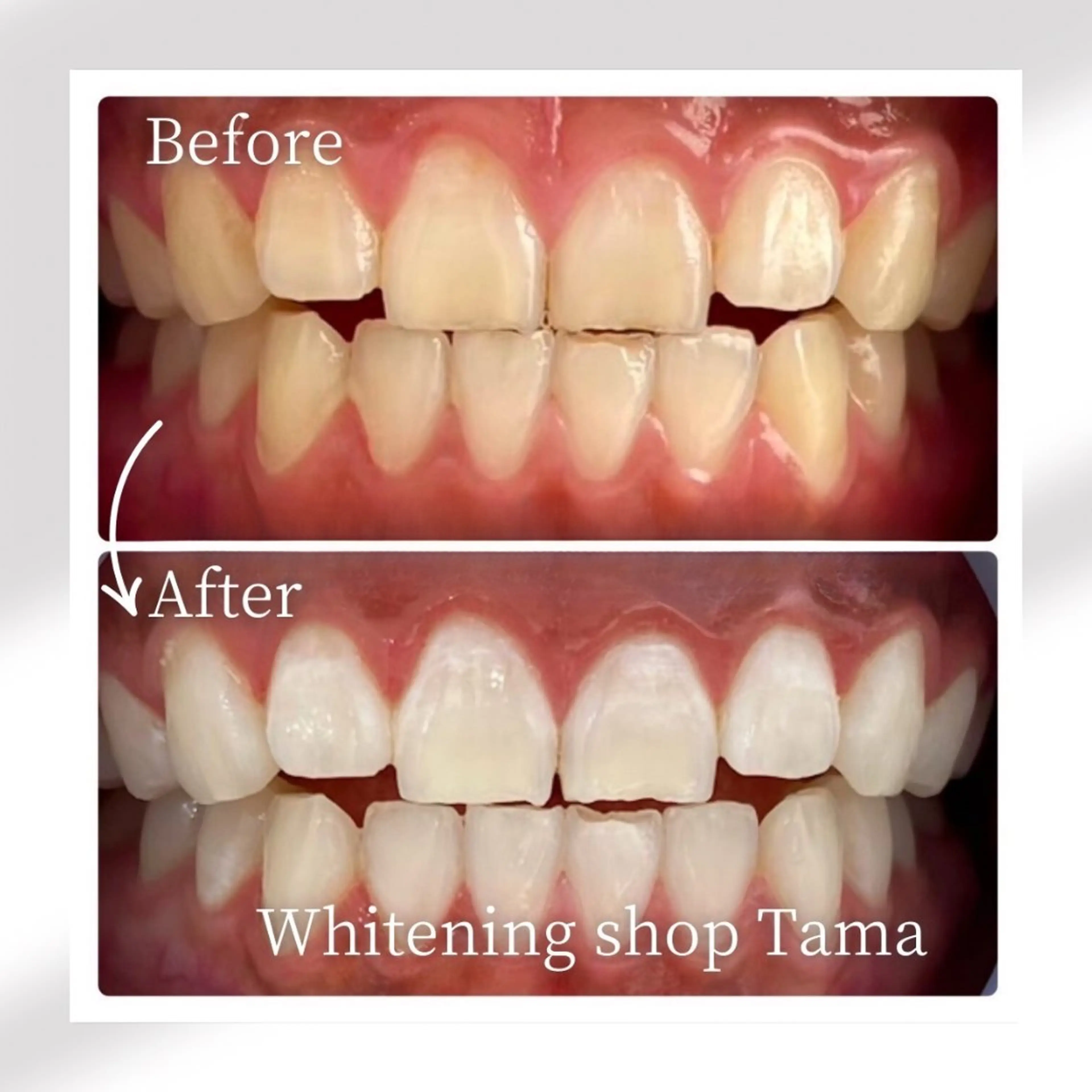 メンズ ホワイトニング ショップ多摩店のその他イメージ