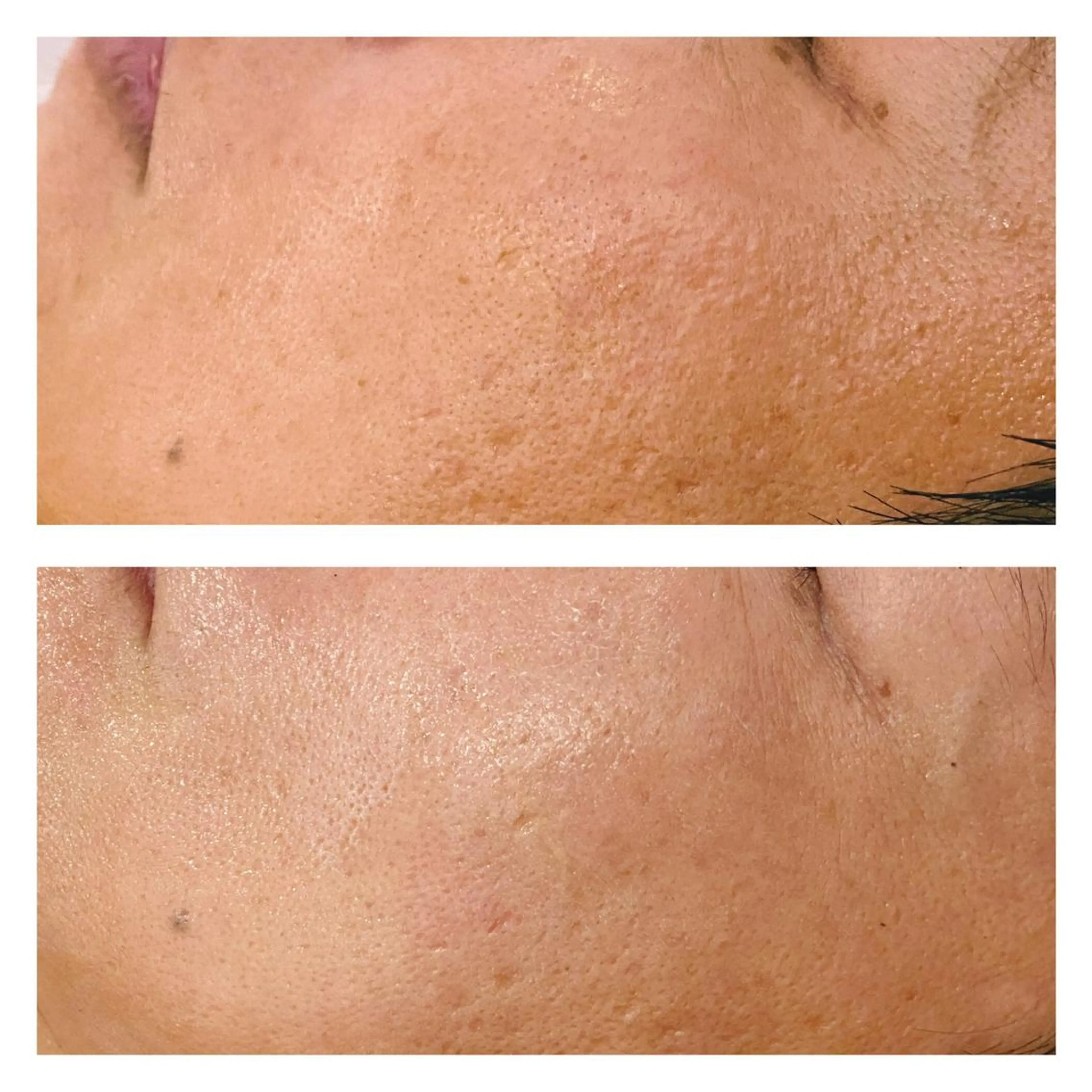 通うほど変わる本格 エステ心斎橋REVIのエステ・リラクイメージ