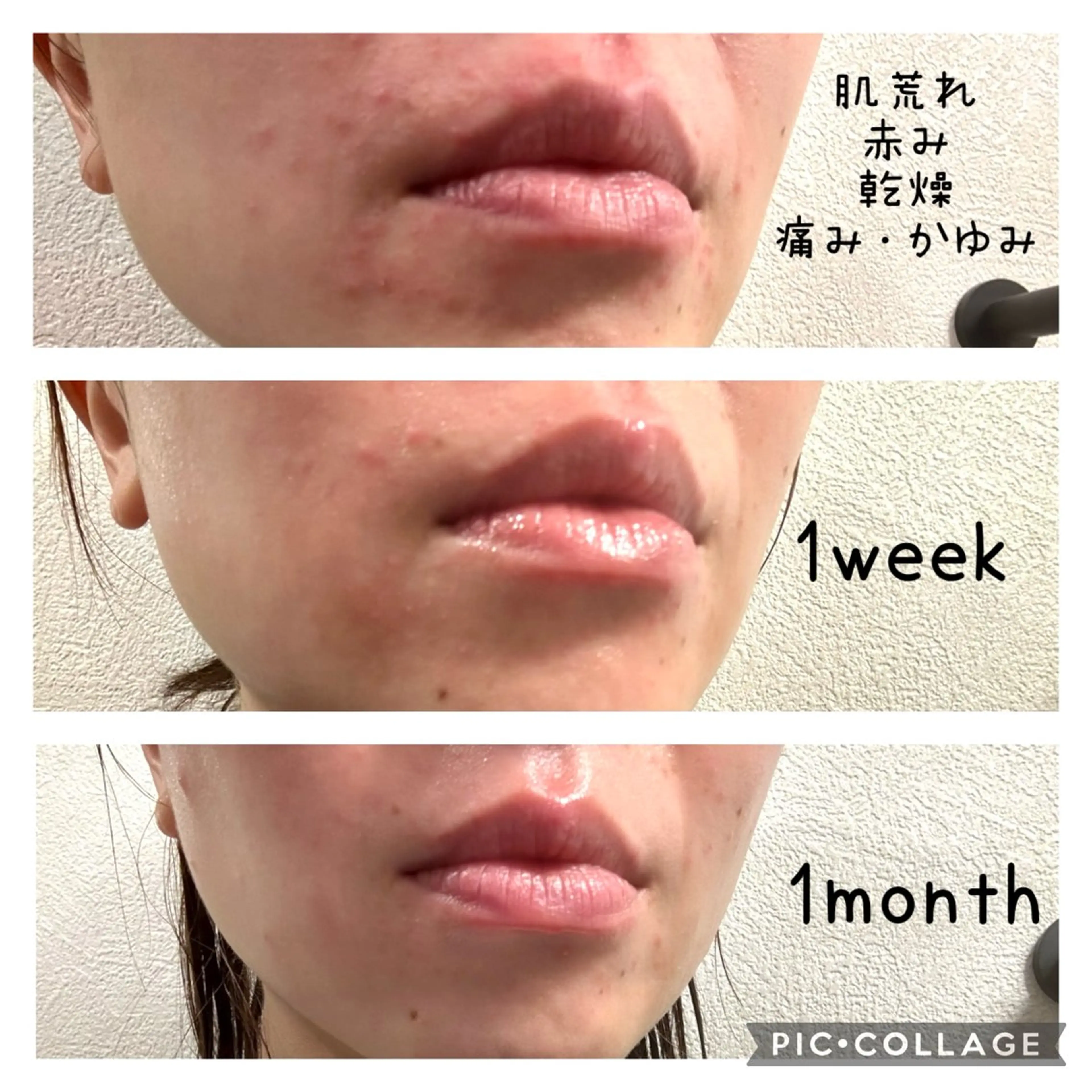 肌改善コースの写真