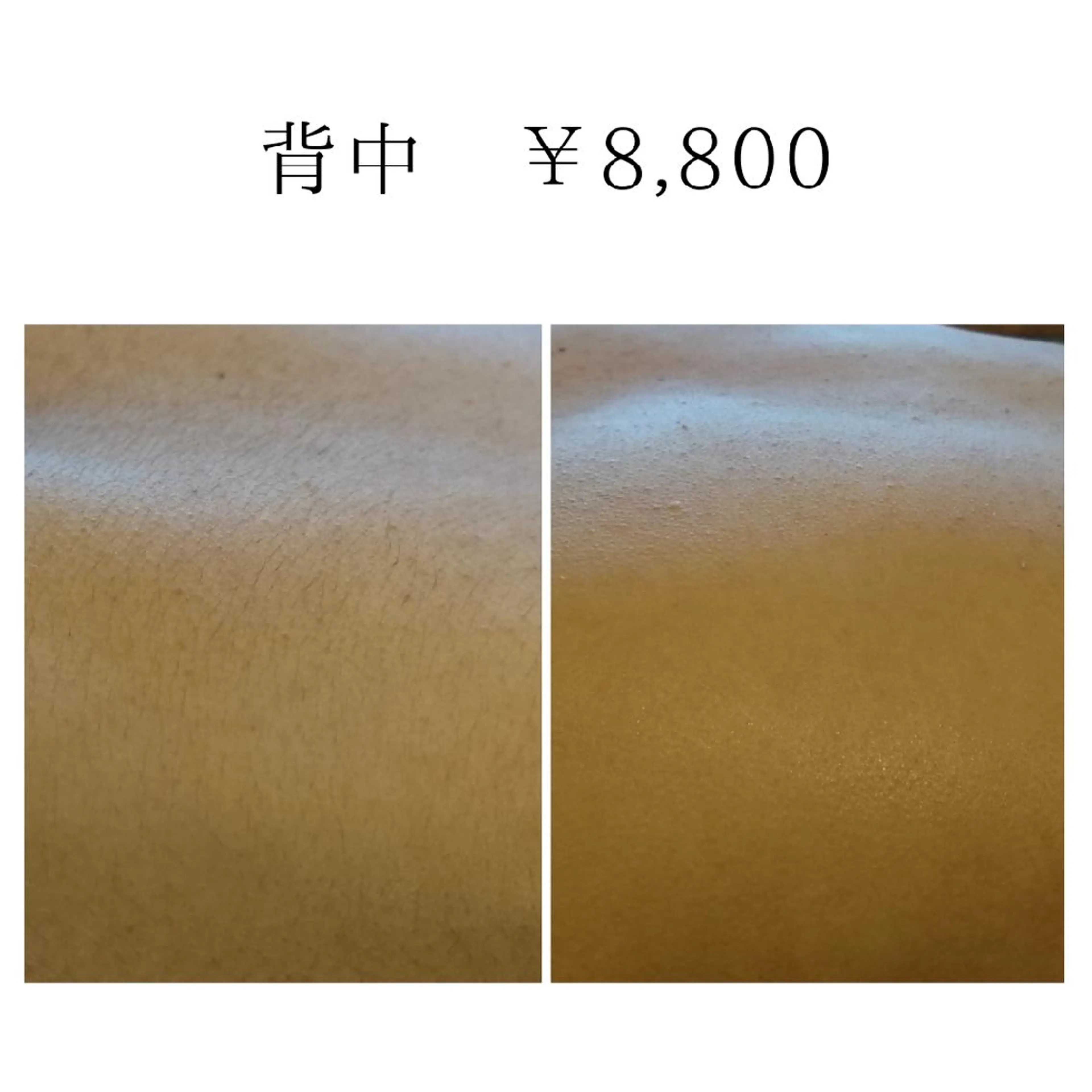 Lutella所属・ワックス脱毛専門店 Lutellaのエステ・リラクイメージ