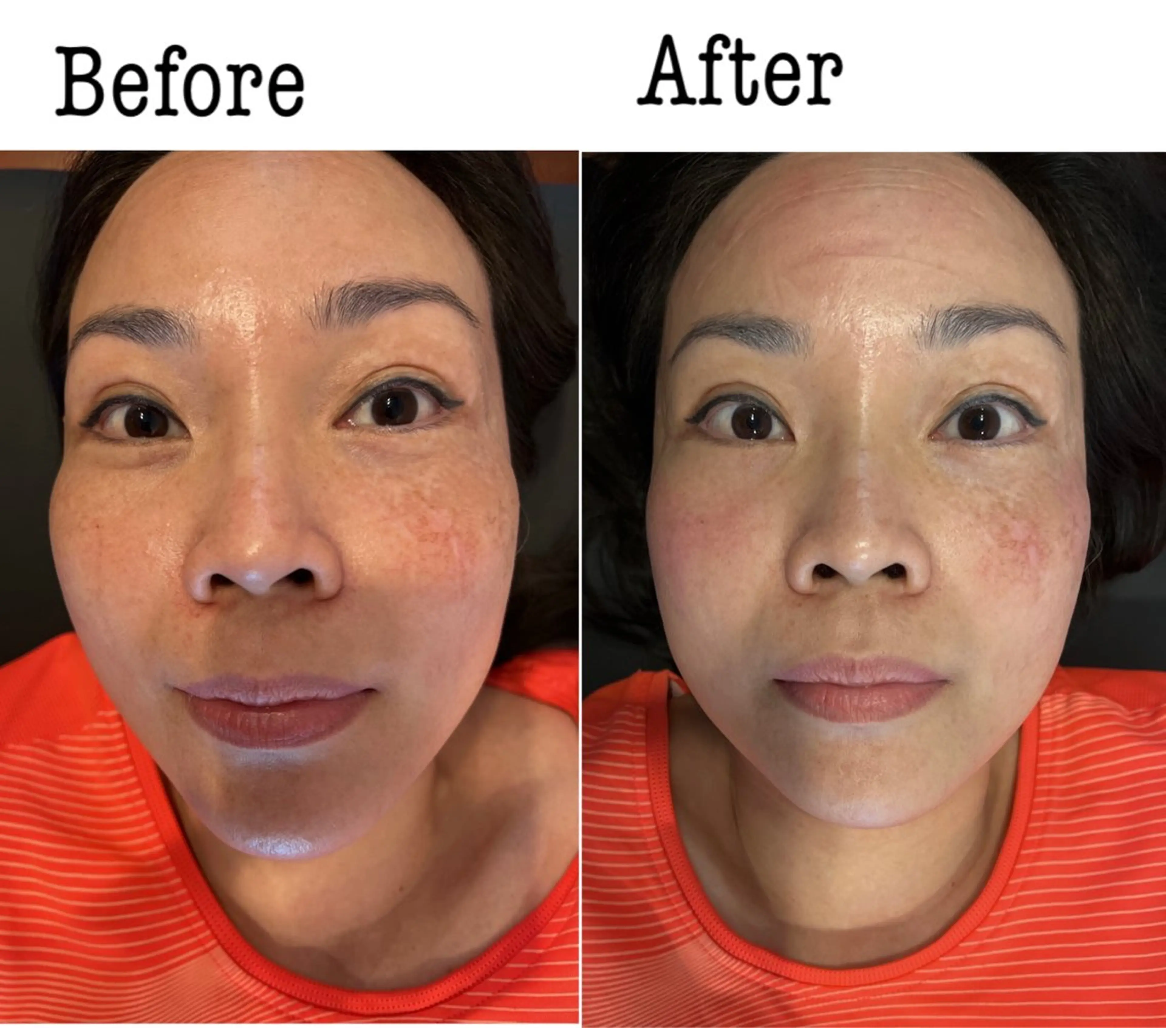 Anne’s happyBonesのエステ・リラクイメージ