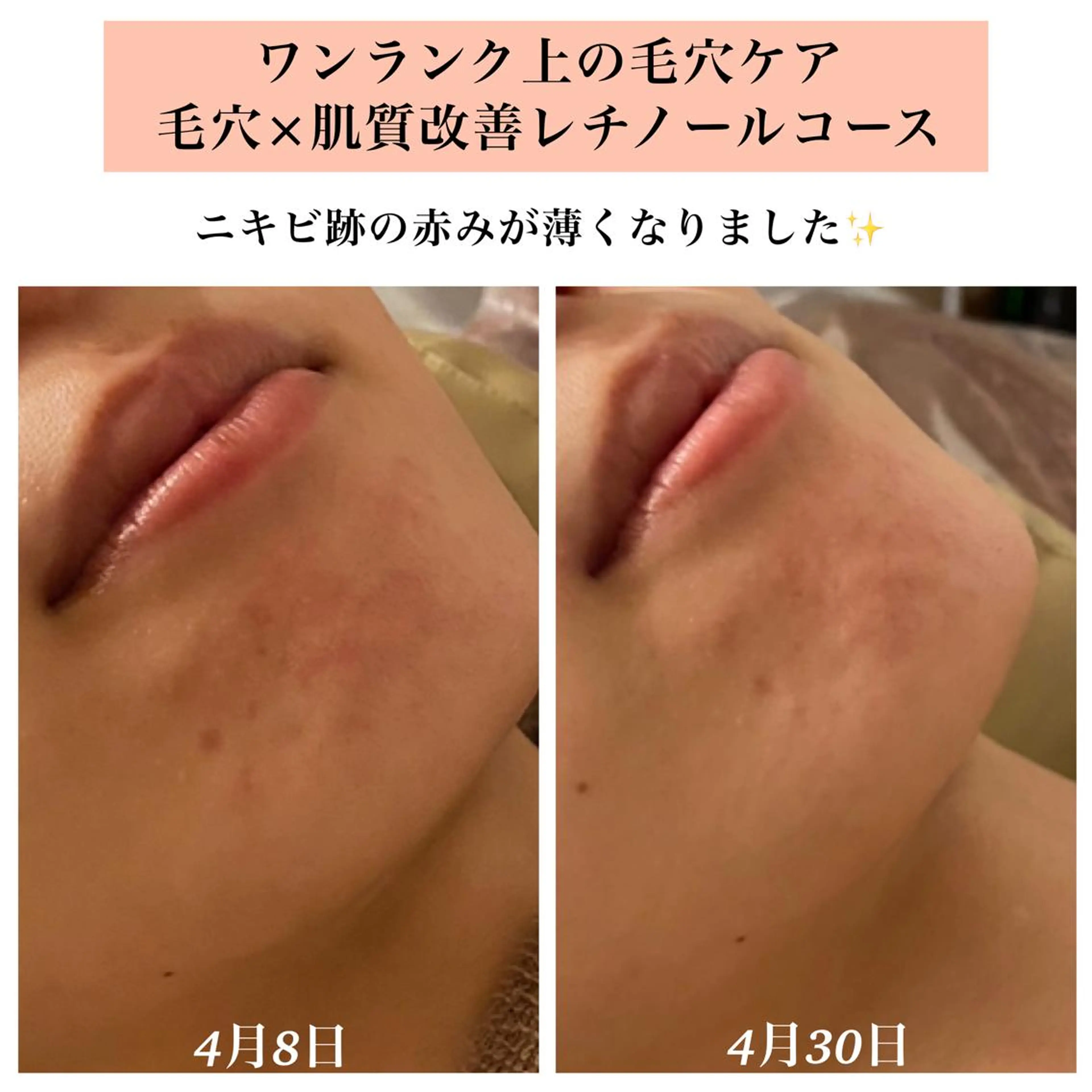 エステ リラク Bellesthe （ベルエステ）のエステ・リラクイメージ