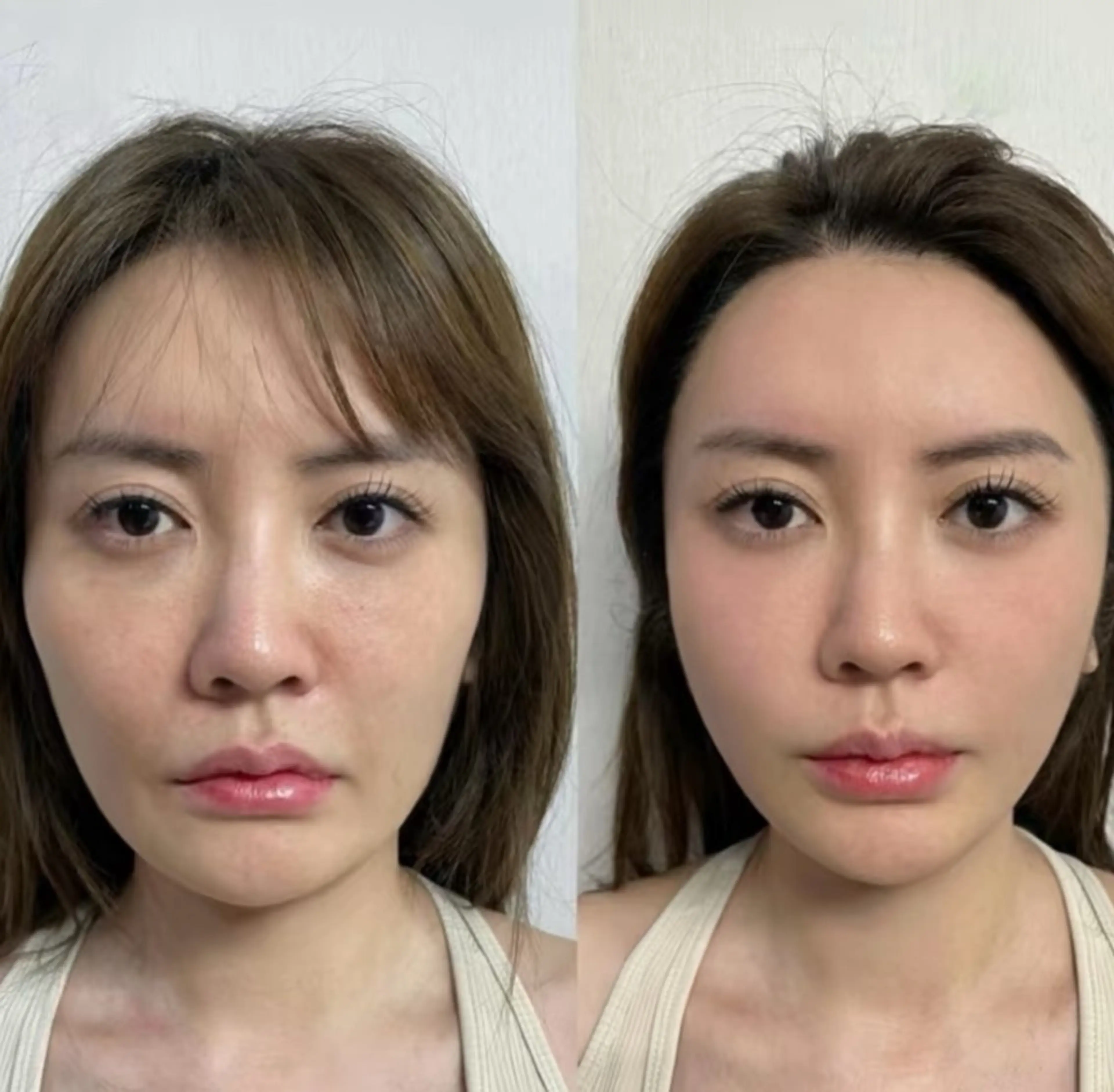 エステ aliaハイフ&水光ジェットサロン所属・aliaハーブ水光店 エステティシャン募集のエステ・リラクイメージ