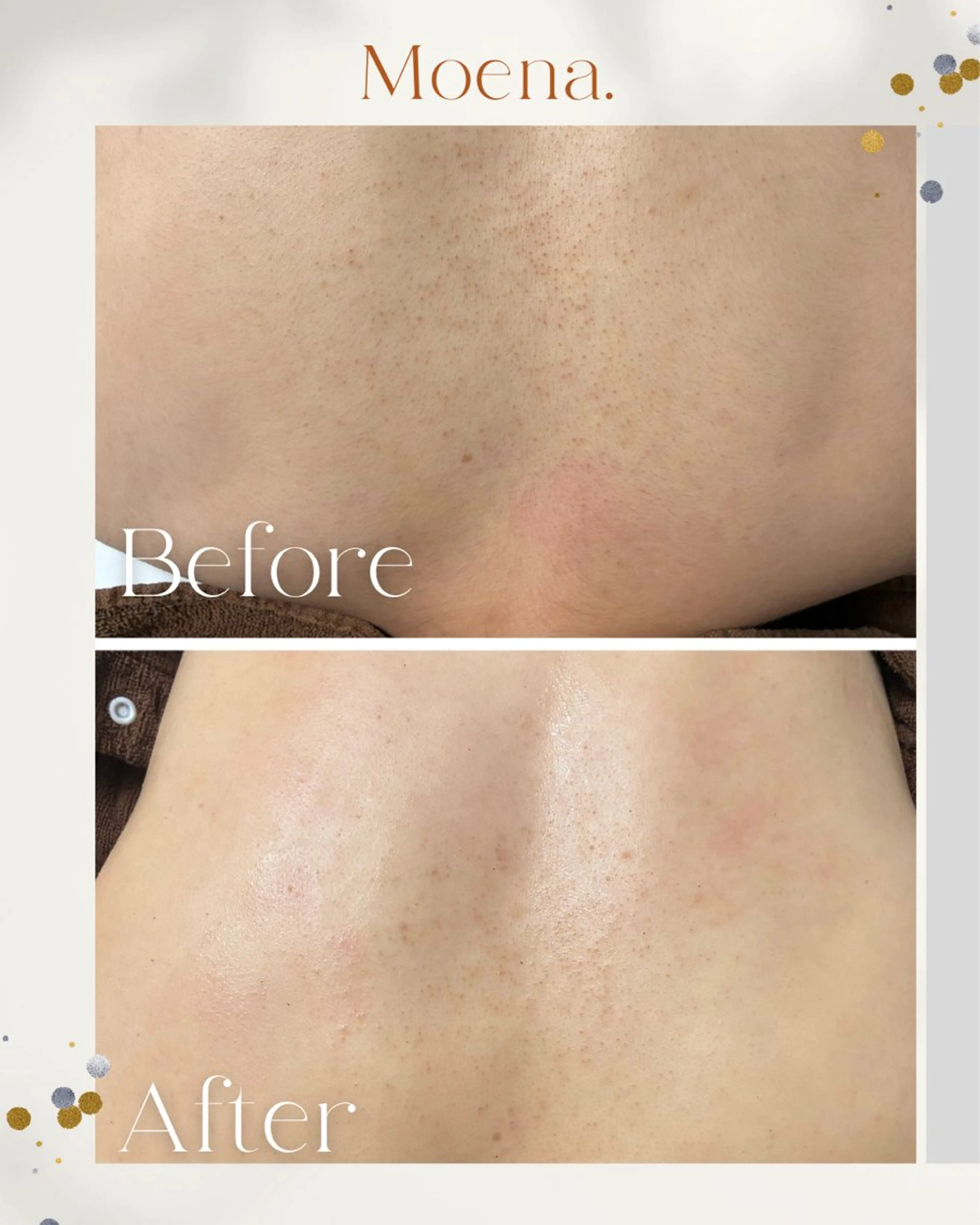 エステ Moena.所属・Moena. 武蔵小杉🫧のエステ・リラクイメージ