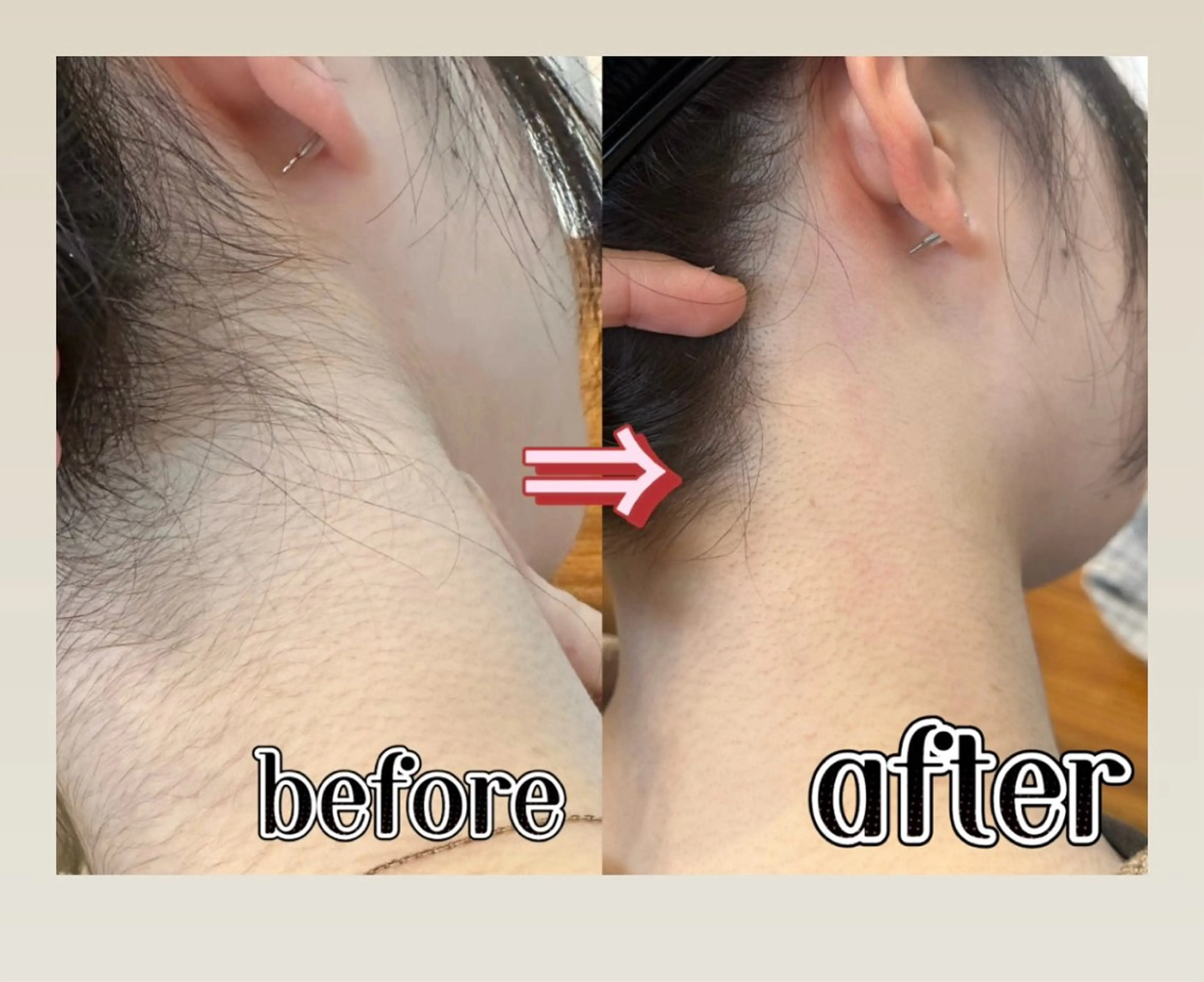 脱毛 浮腫|肩こり|張り 日々の疲れを解消★のエステ・リラクイメージ