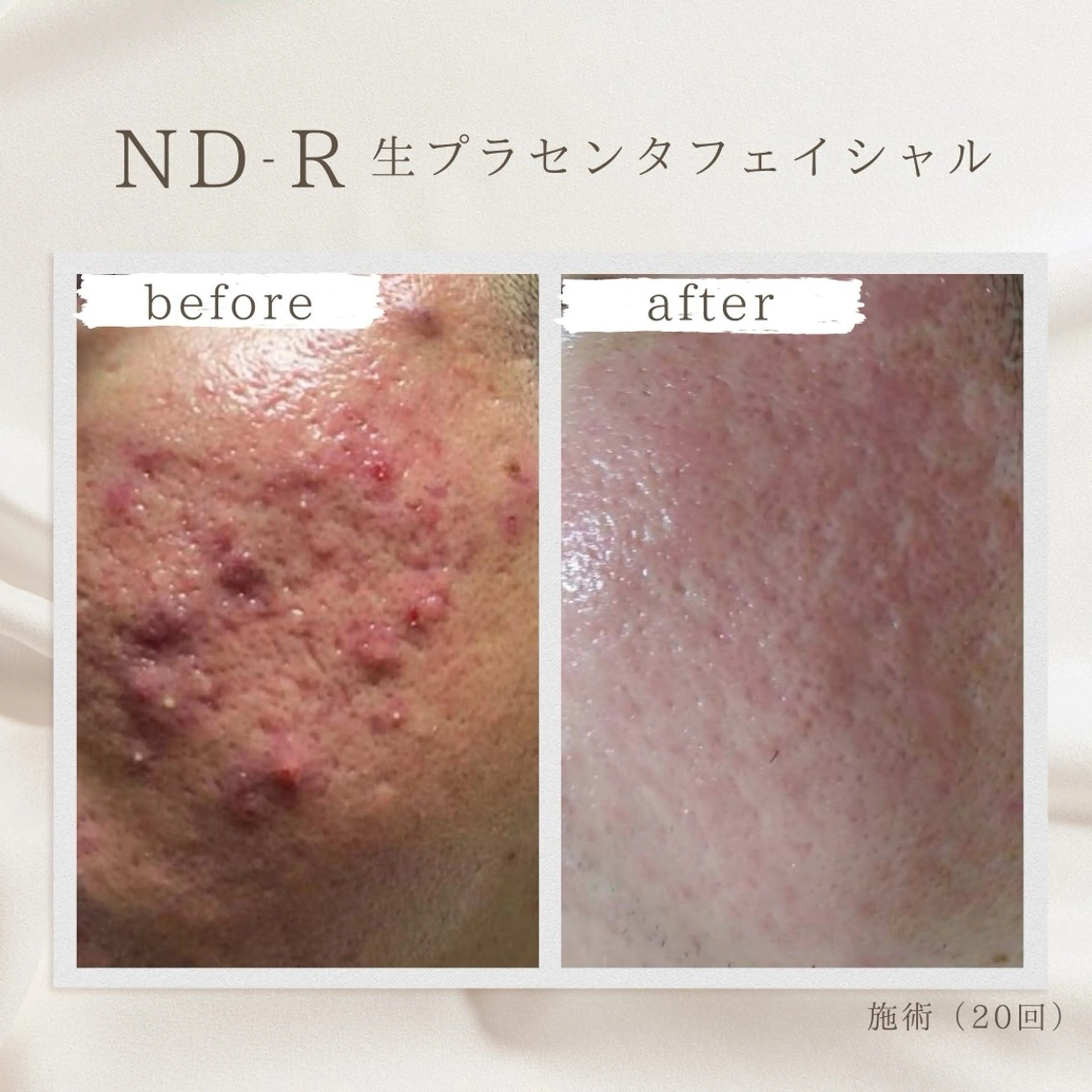 Charm ✿suzuのエステ・リラクイメージ