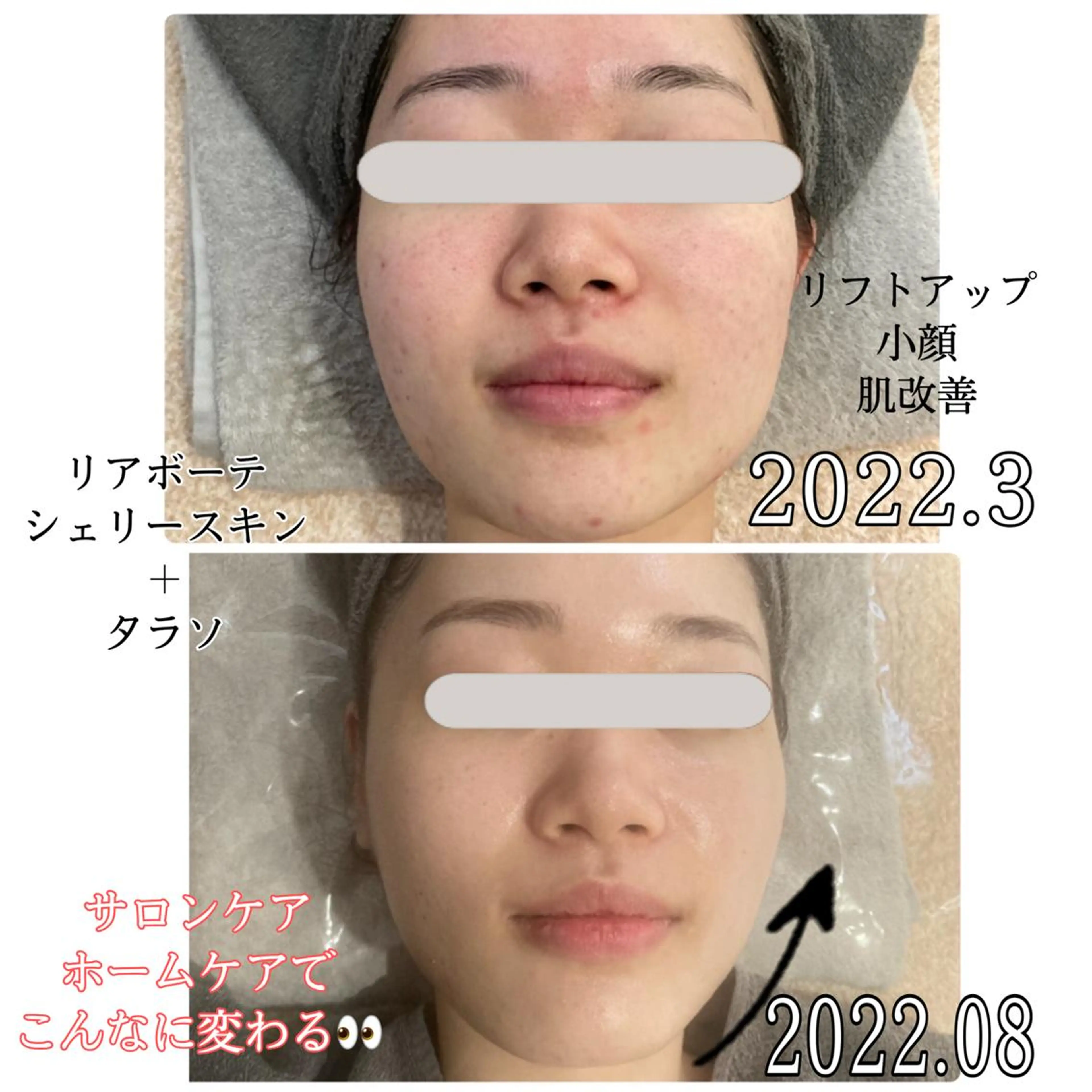 marron所属・痩身ハイパーナイフ ララピールリアボーテのエステ・リラクイメージ