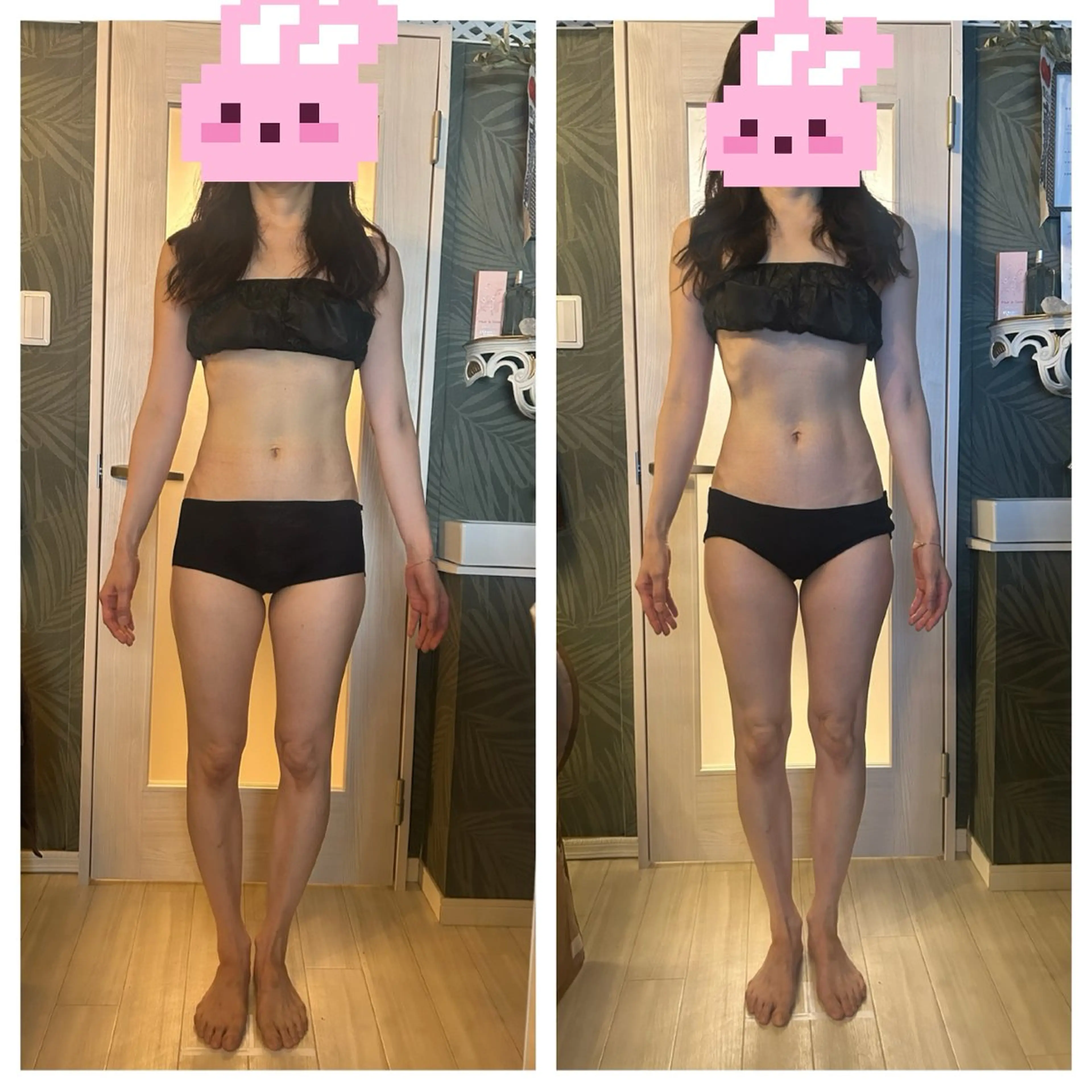 【1か月集中ダイエット】痩身マシーンモニター募集♪（1か月間に4回トリートメントビフォーアフター写真を撮らせて下さる方）の写真