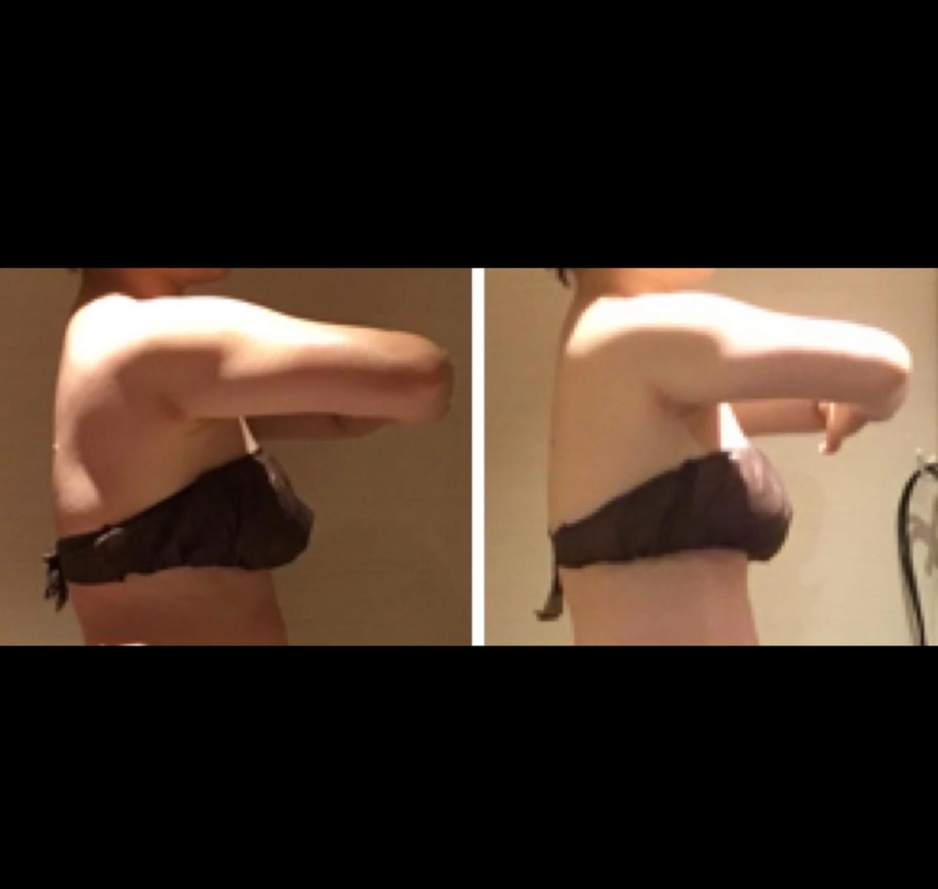 【お腹・背中～首・二の腕など】上半身徹底コース☆60分◯+ホームケアプレゼント¥22000→¥8450の写真