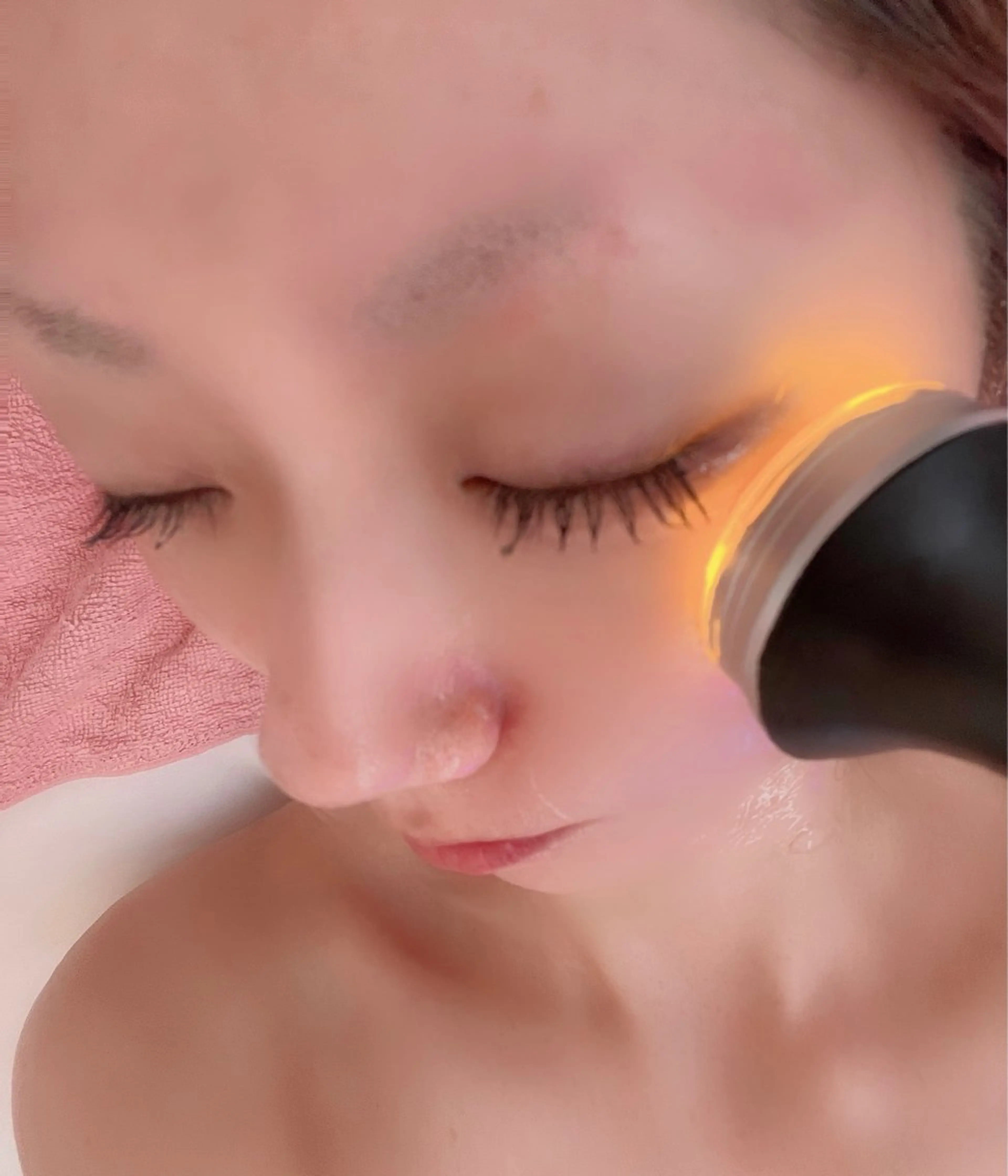 【minimo限定】お肌の底上げ✨サーマルリフトアップフェイシャルの写真