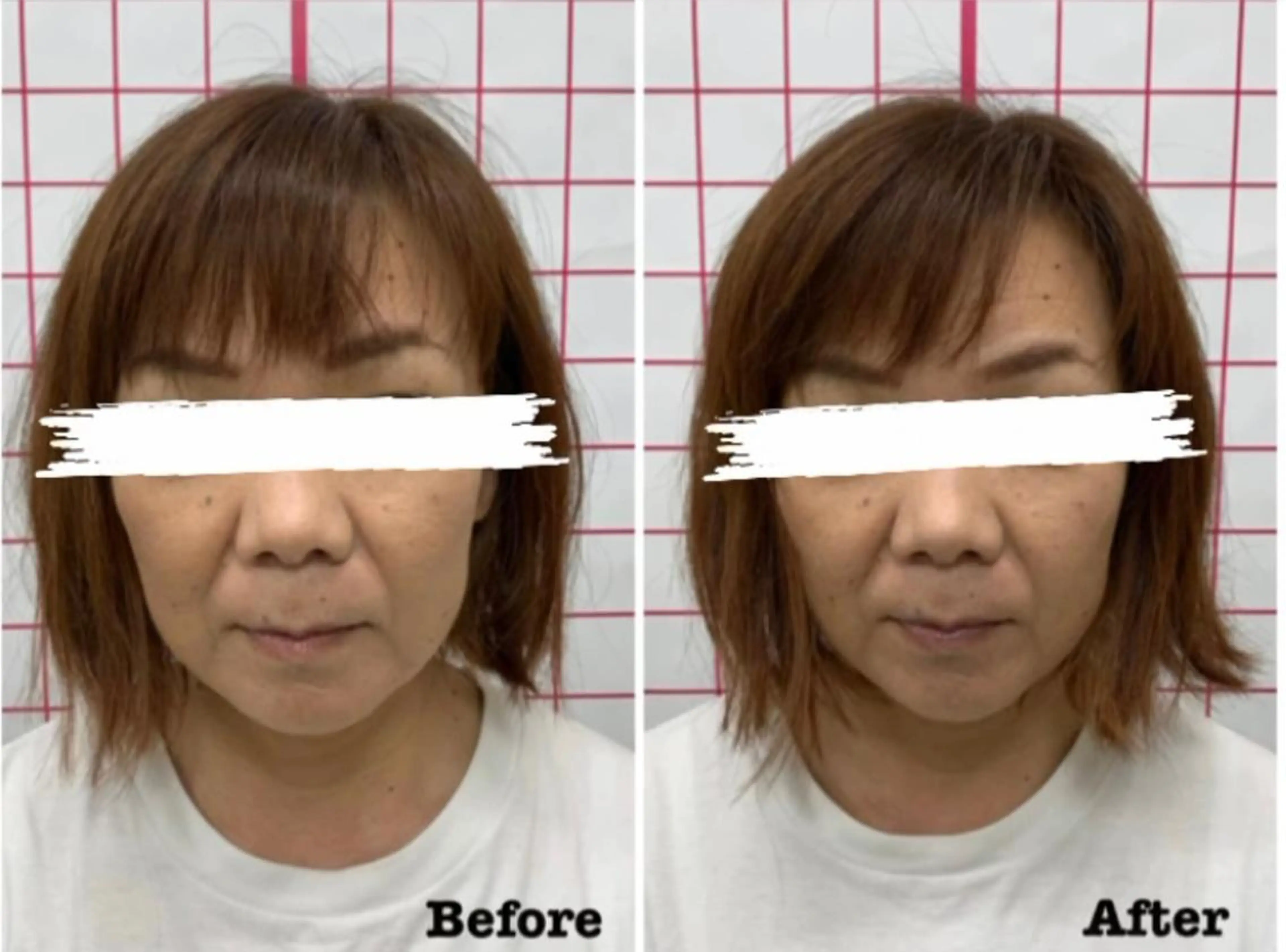 エステ リラク だいち 鍼灸院　伊伝居院のエステ・リラクイメージ