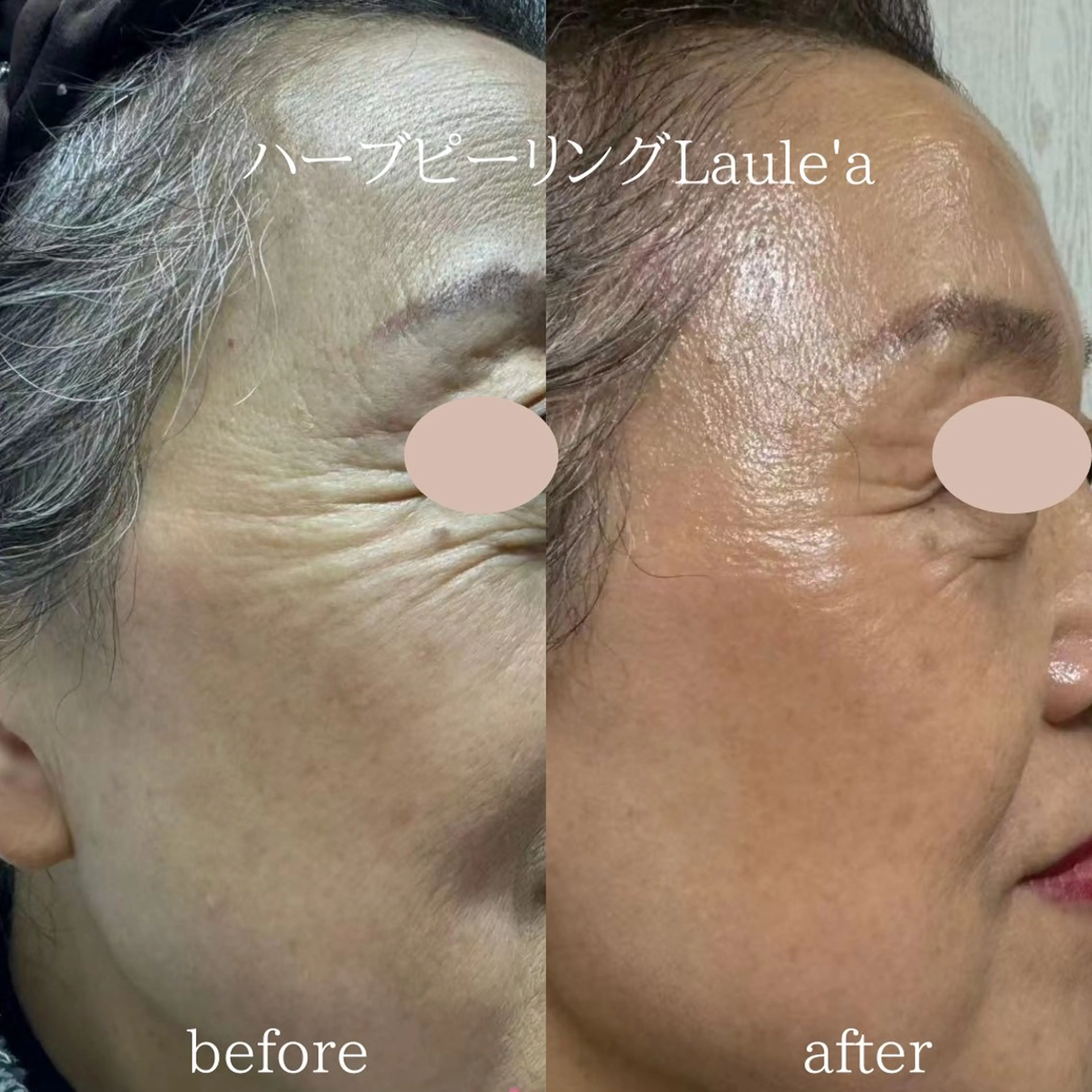 美腸サロン【腸もみ &アロマリンパ】のエステ・リラクイメージ