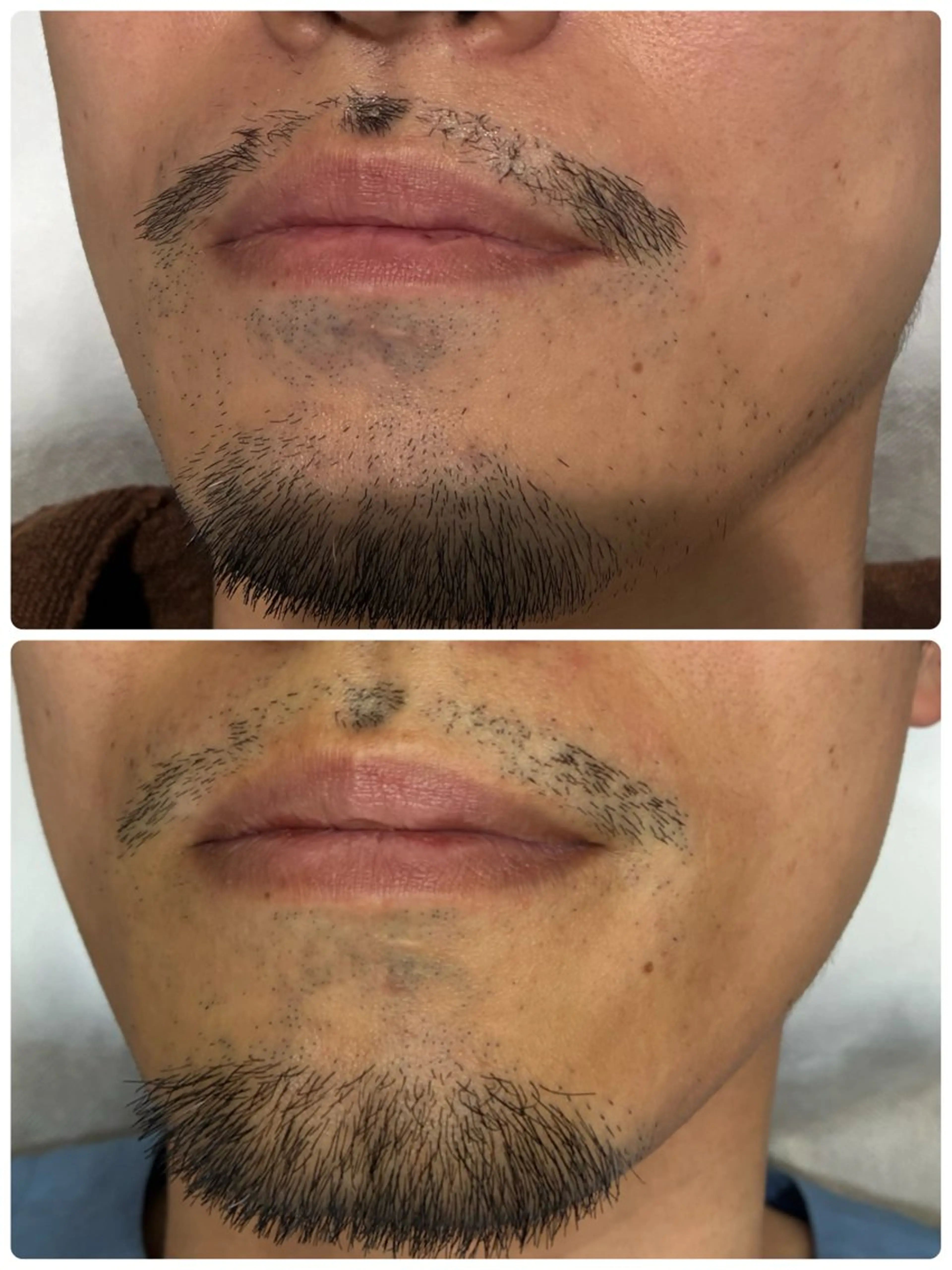 EstheticSalonReTweet所属・竹谷 春希のエステ・リラクイメージ