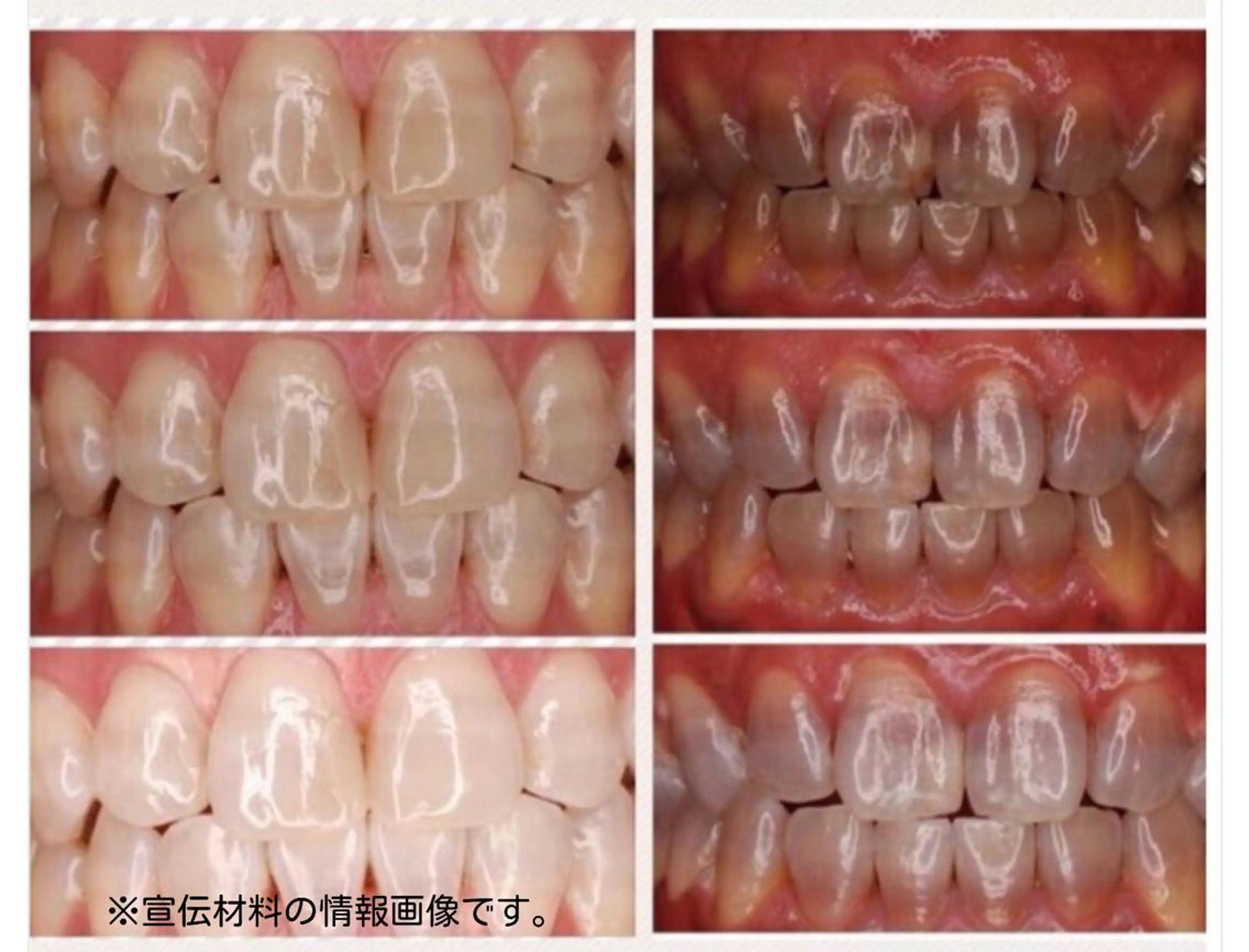 Rei to　youのマツエク・マツパデザイン